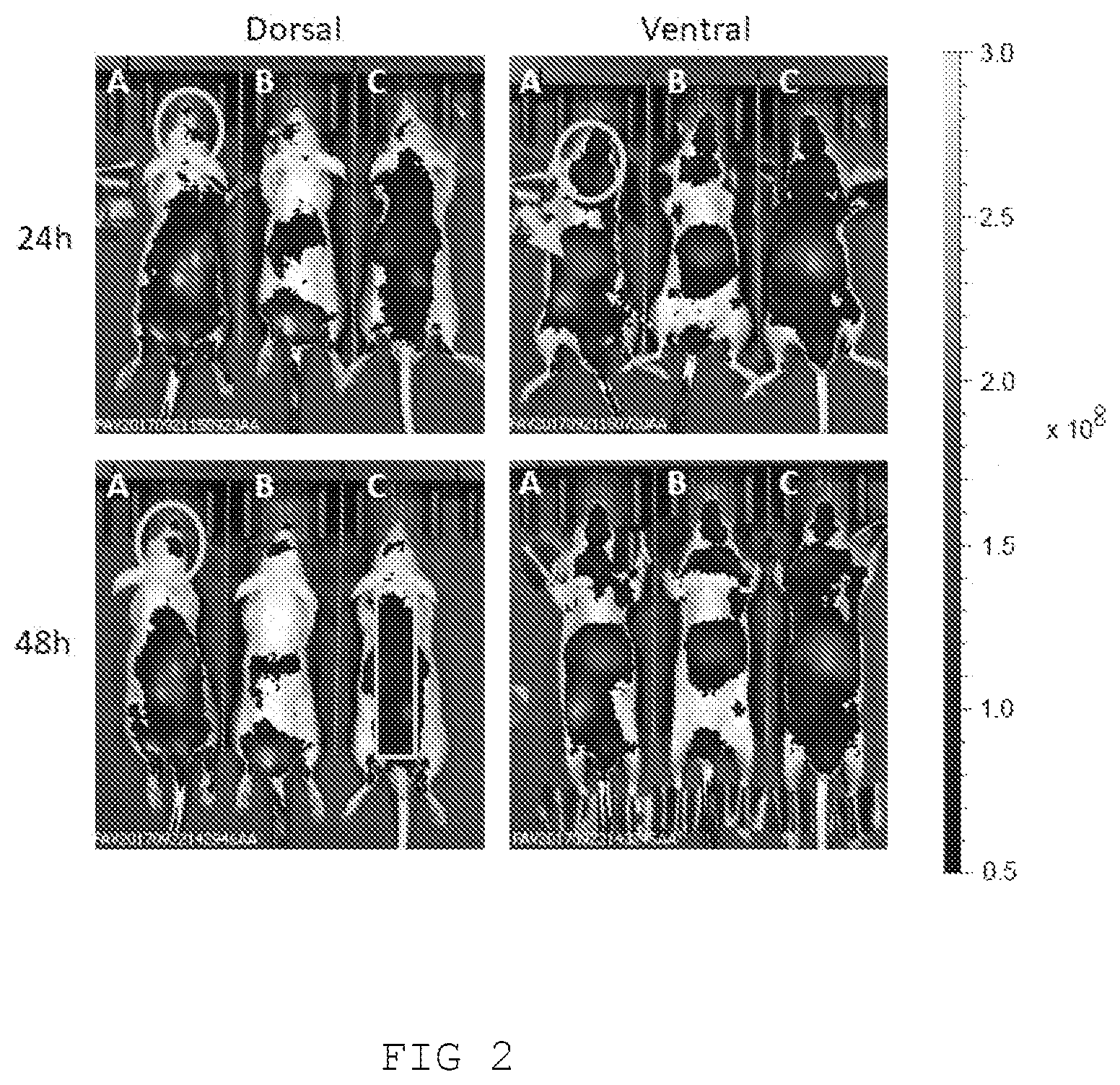 Patent US12611419 Figure 2 – Liposomal composition for use in a method of treating Parkinson's disease