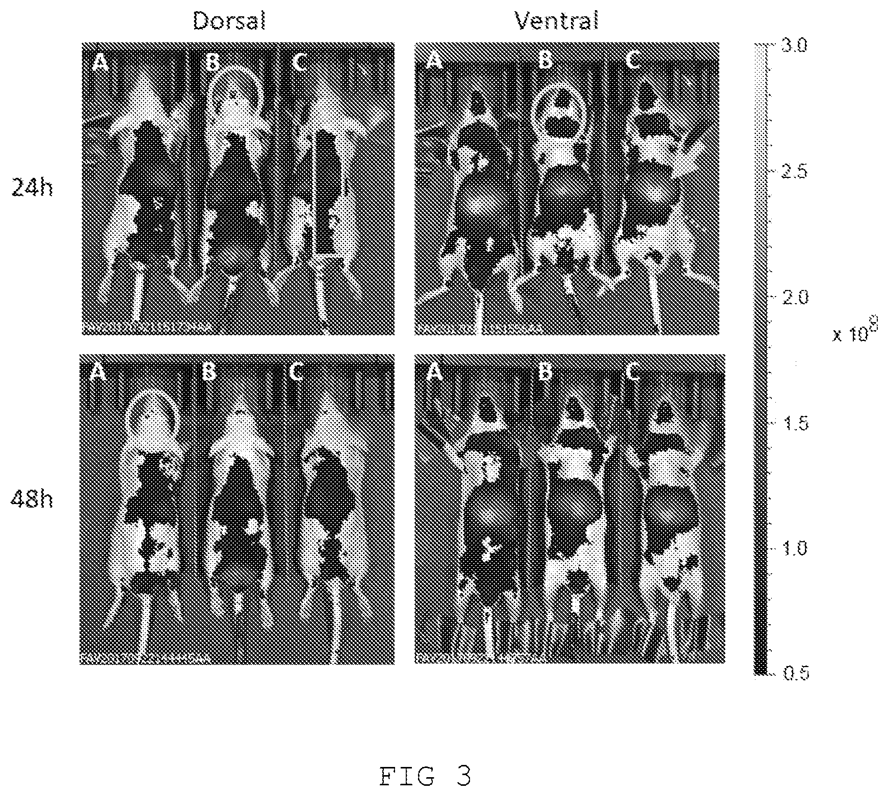 Patent US12611419 Figure 3 – Liposomal composition for use in a method of treating Parkinson's disease