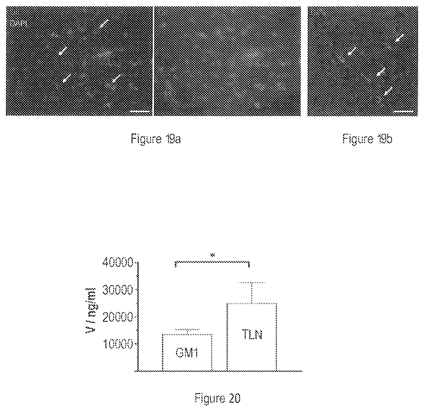 Patent US12611419 Figure 13 – Liposomal composition for use in a method of treating Parkinson's disease