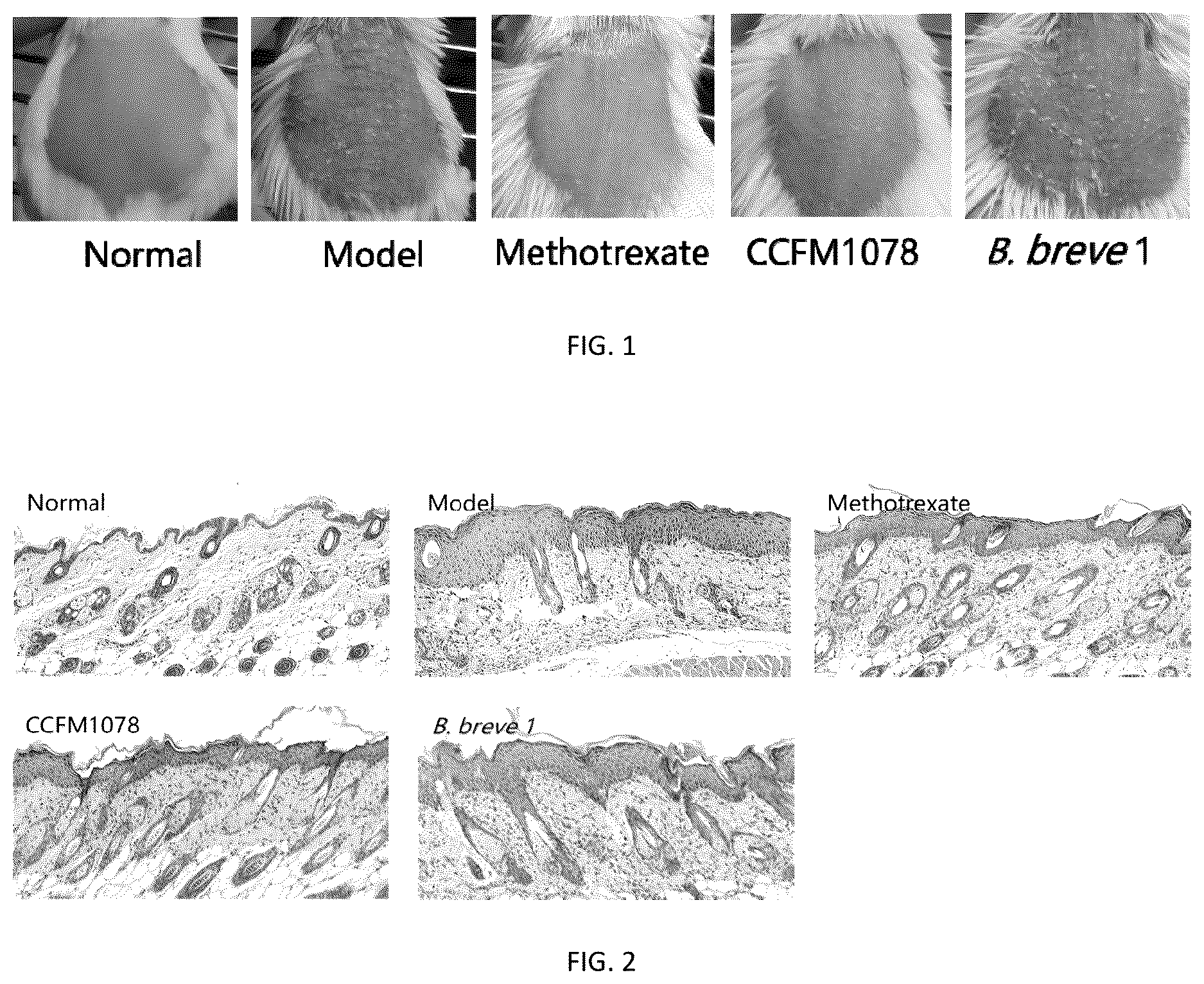 Patent US12611434 Figure 1 – Bifidobacterium brevis and its application in preventing or alleviating psoriasis thereof
