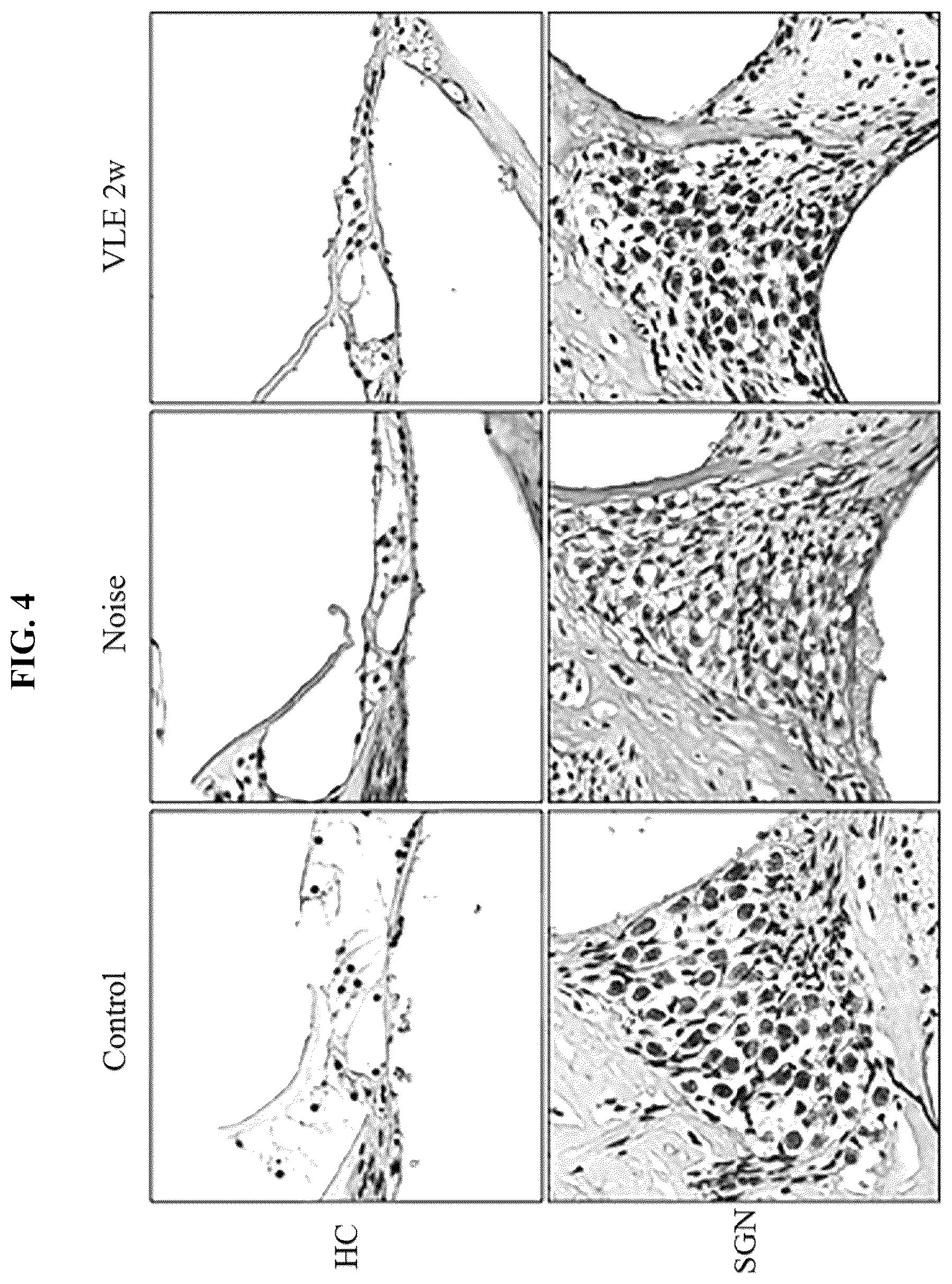 Patent US12611437 Figure 4 – Composition for preventing or treating tinnitus comprising Vitis vinifera leaf extract as active ingredient