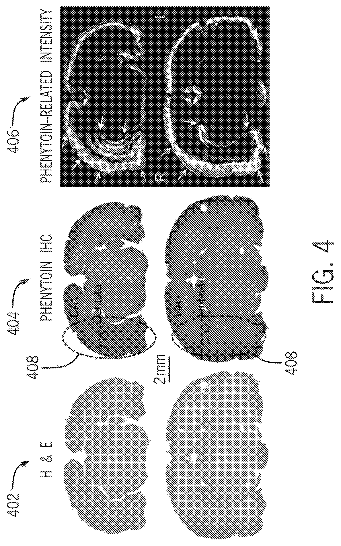 Patent US12611459 Figure 4 – System and method for unbinding of plasma protein-bound active agents using an ultrasound system