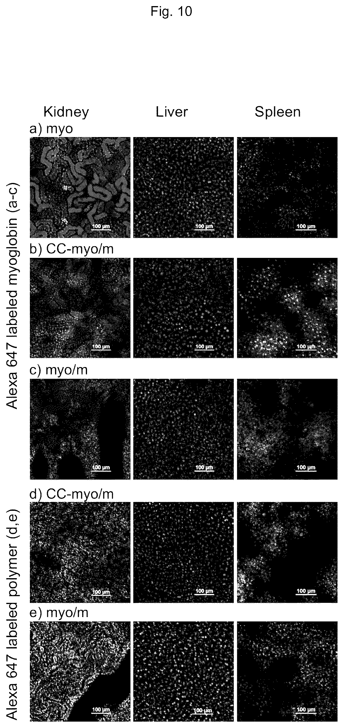 Patent US12611465 Figure 10 – Protein-enclosing polymeric micelle