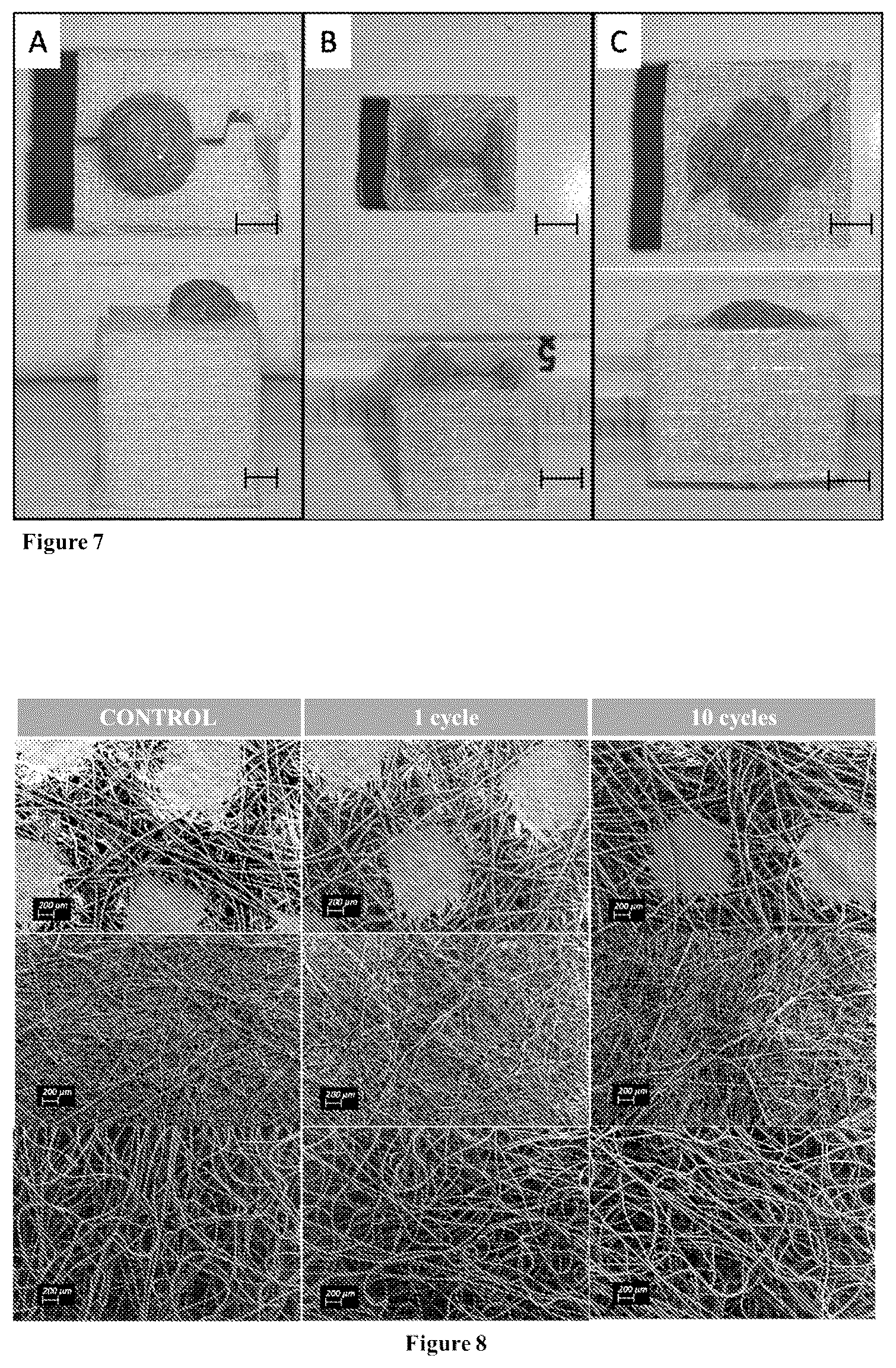 Patent US12611475 Figure 6 – System for implantation by sterilisation techniques