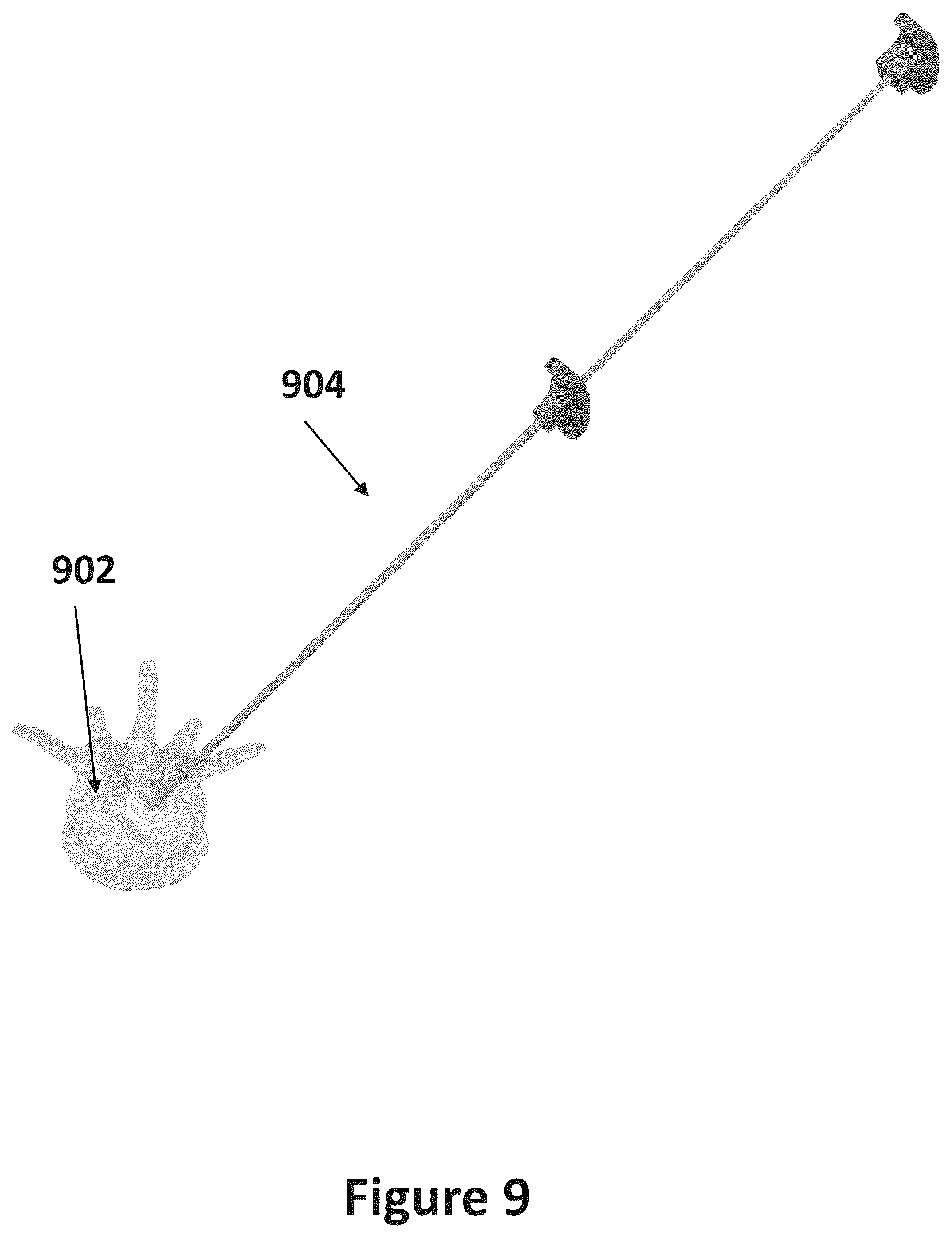 Patent US12611483 Figure 10 – Implant comprising a plurality of hardening states