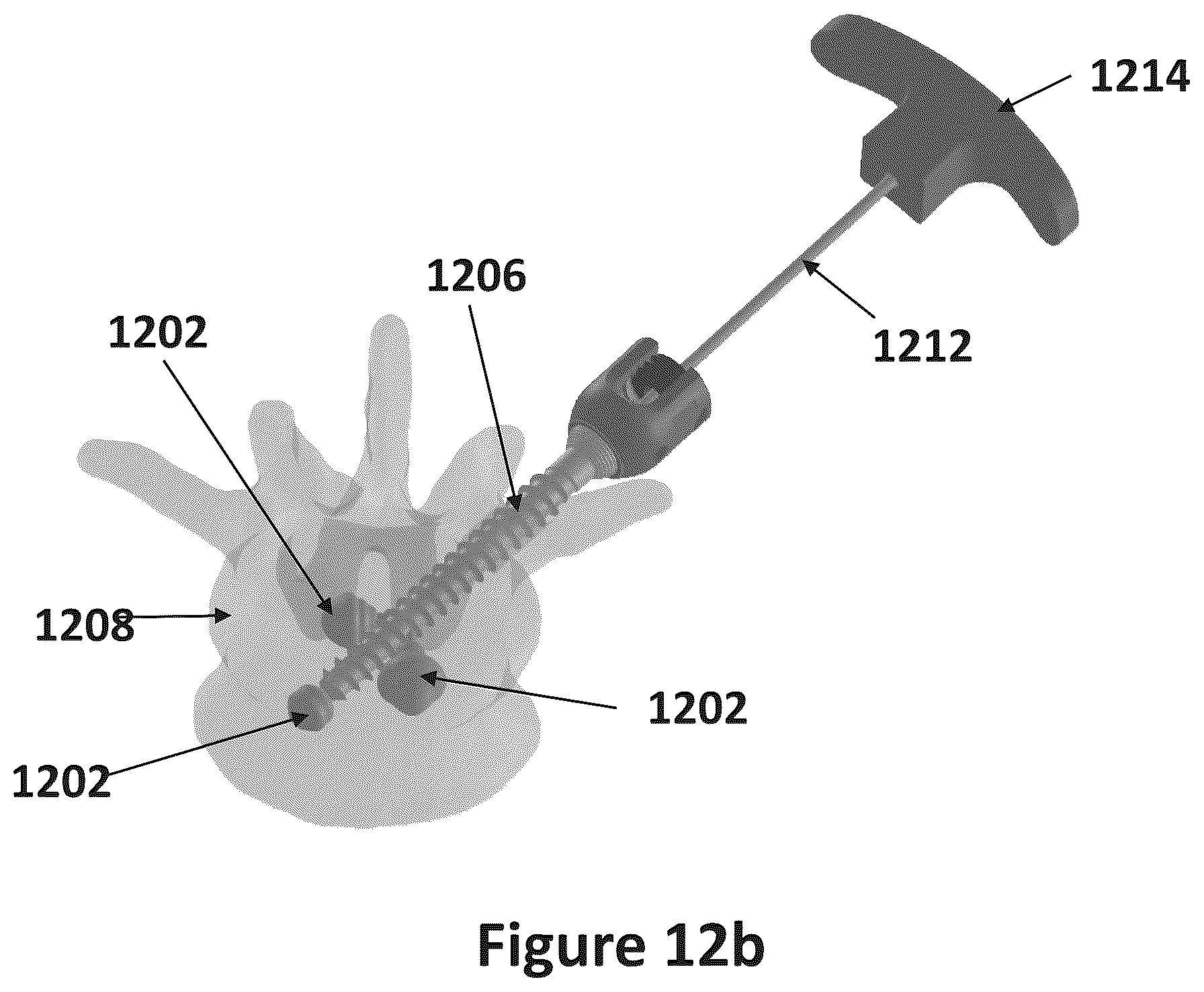 Patent US12611483 Figure 15 – Implant comprising a plurality of hardening states