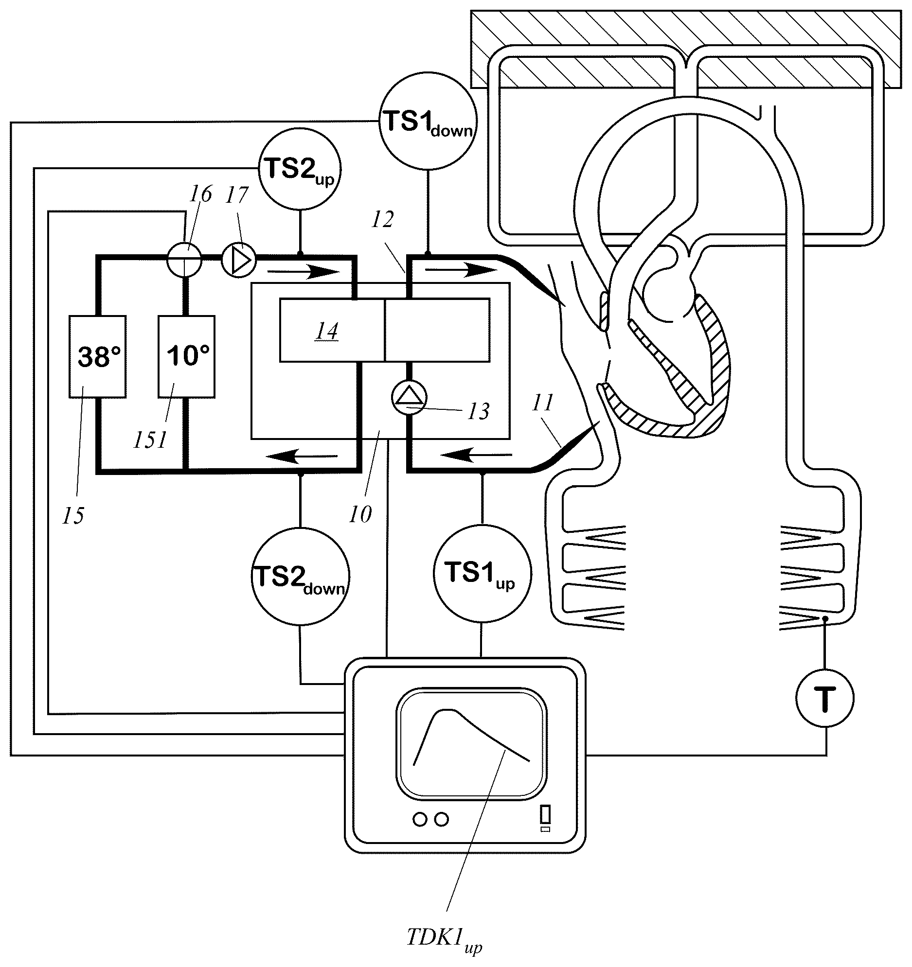 Patent US12611493 Figure 1 – Extracorporeal blood treatment device with function-monitoring system