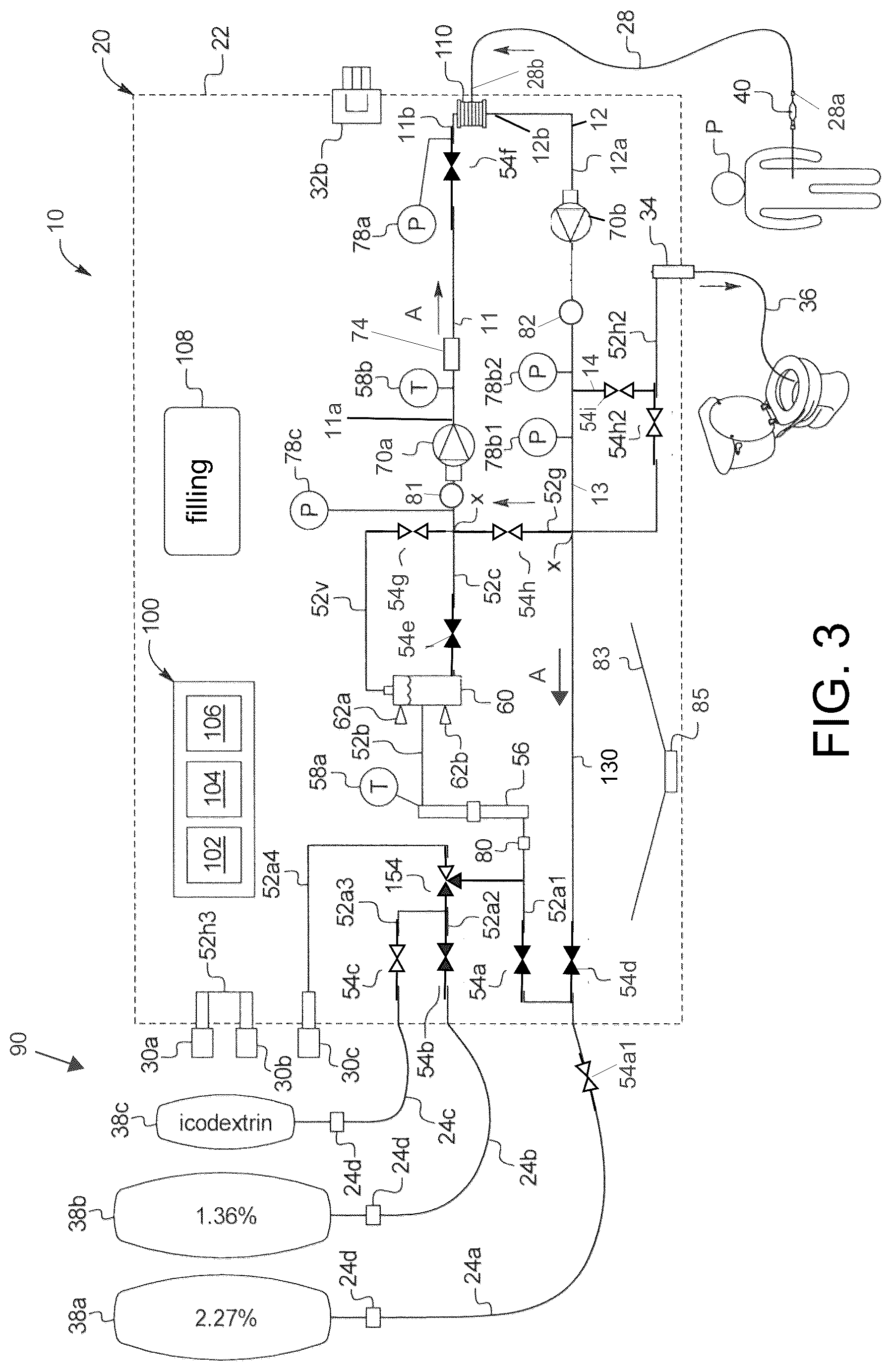 Patent US12611497 Figure 3 – Peritoneal dialysis circuit