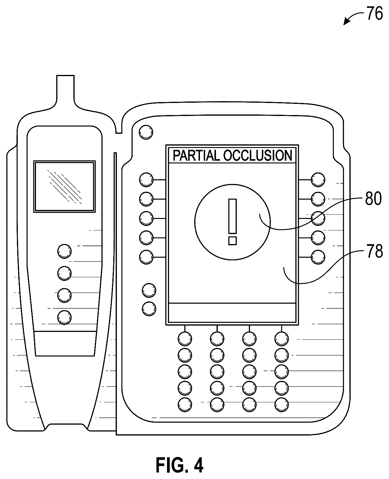 Patent US12611498 Figure 7 – Occlusion detection devices, systems, and methods
