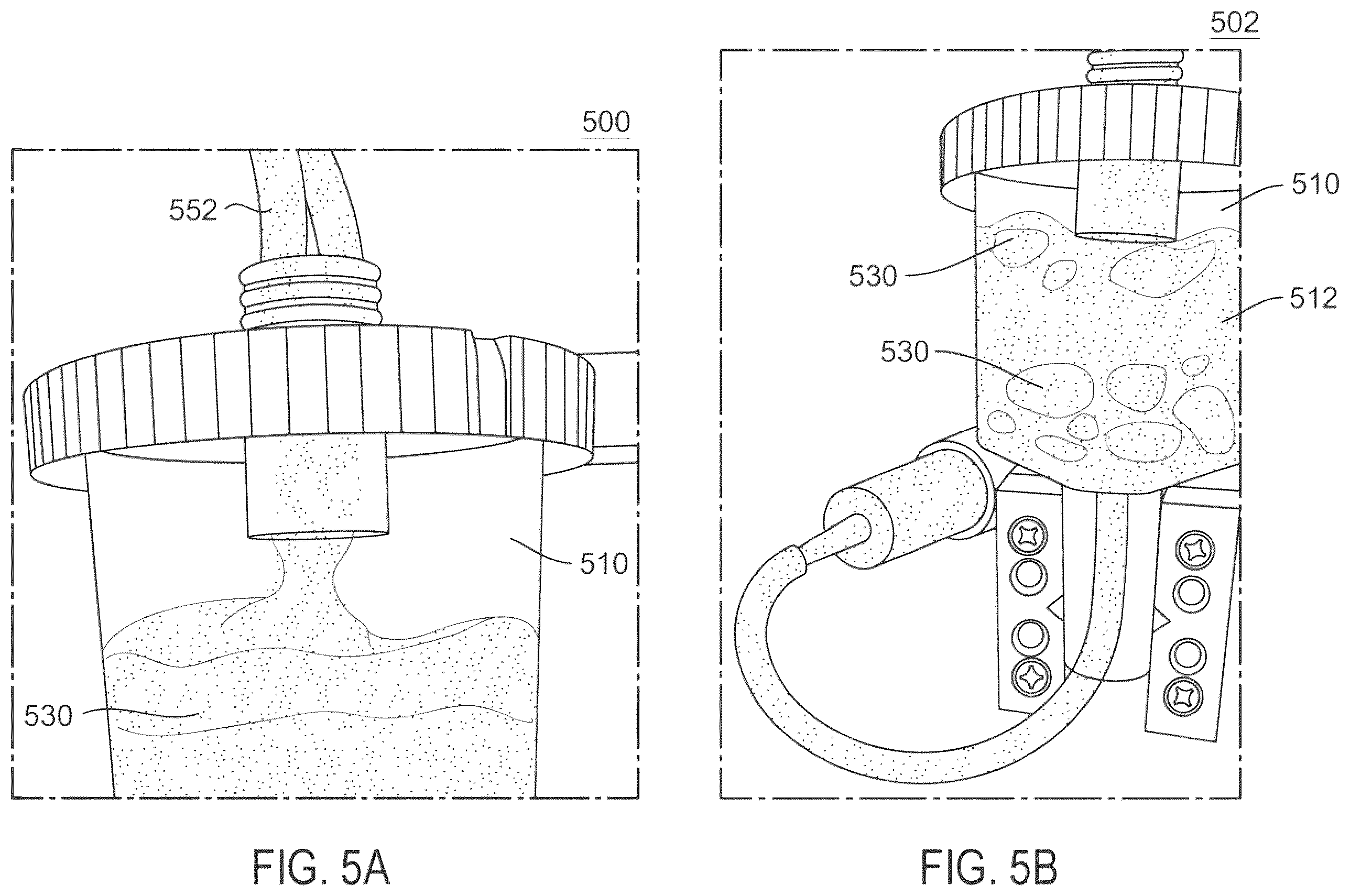 Patent US12611499 Figure 10 – Blood transfusion for thrombectomy devices, and systems and methods thereof