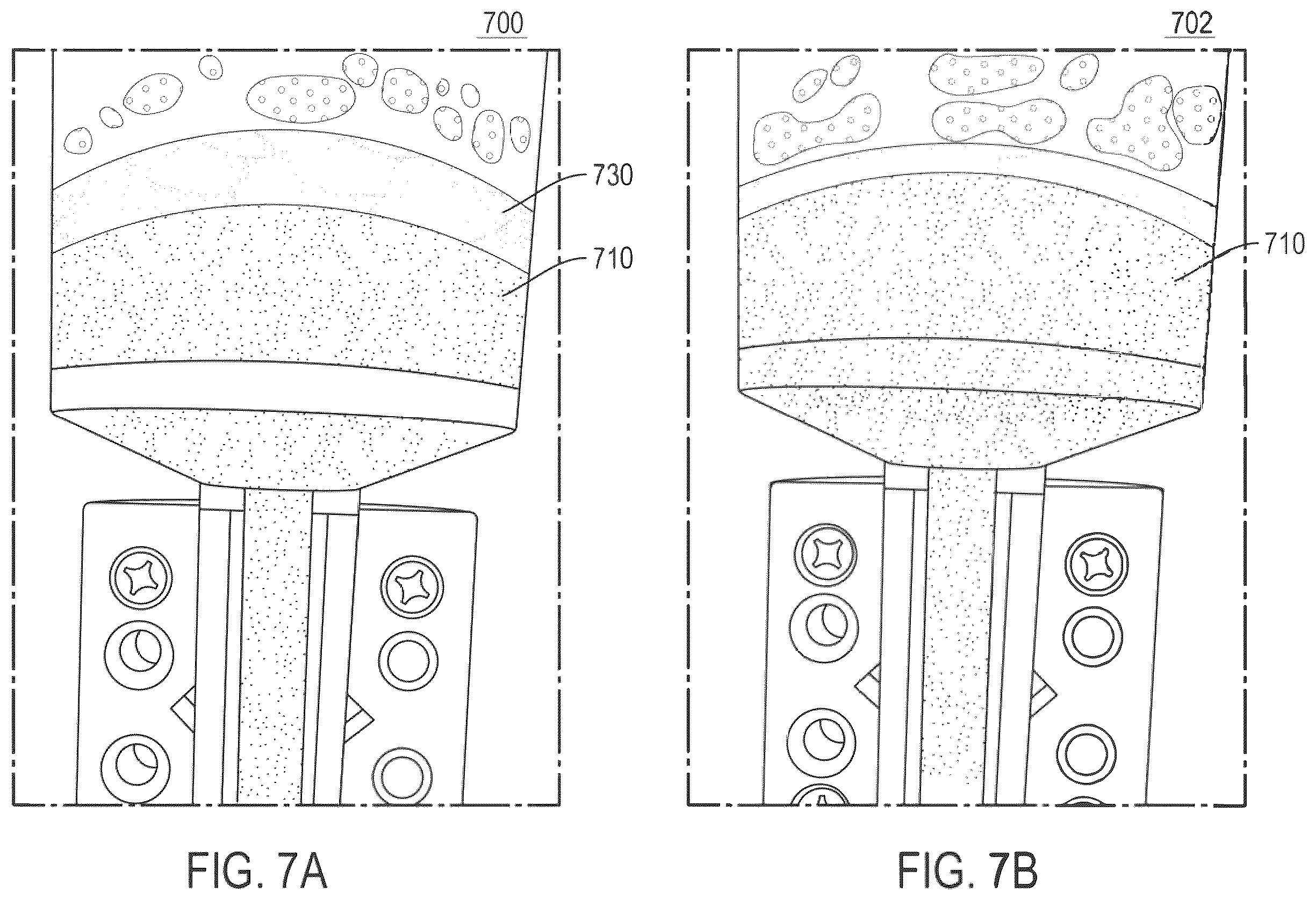 Patent US12611499 Figure 12 – Blood transfusion for thrombectomy devices, and systems and methods thereof