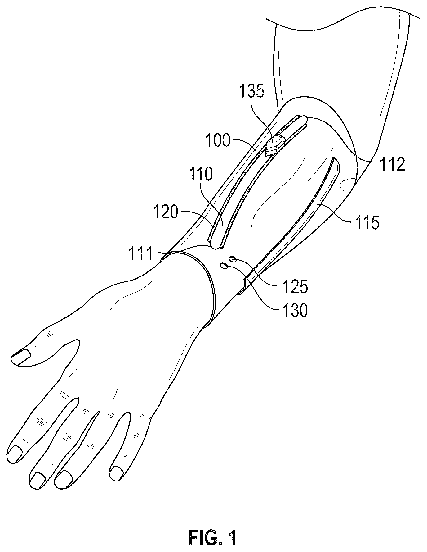 Patent US12611512 Figure 1 – Catheter placement device and related methods