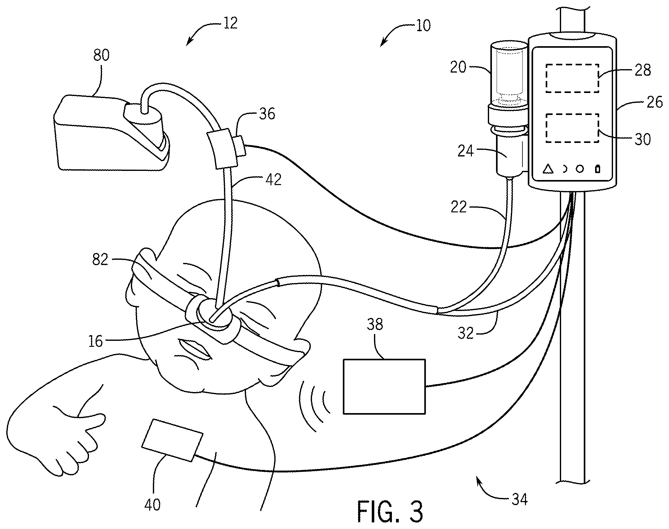 Patent US12611513 Figure 3 – Aerosol delivery system and method