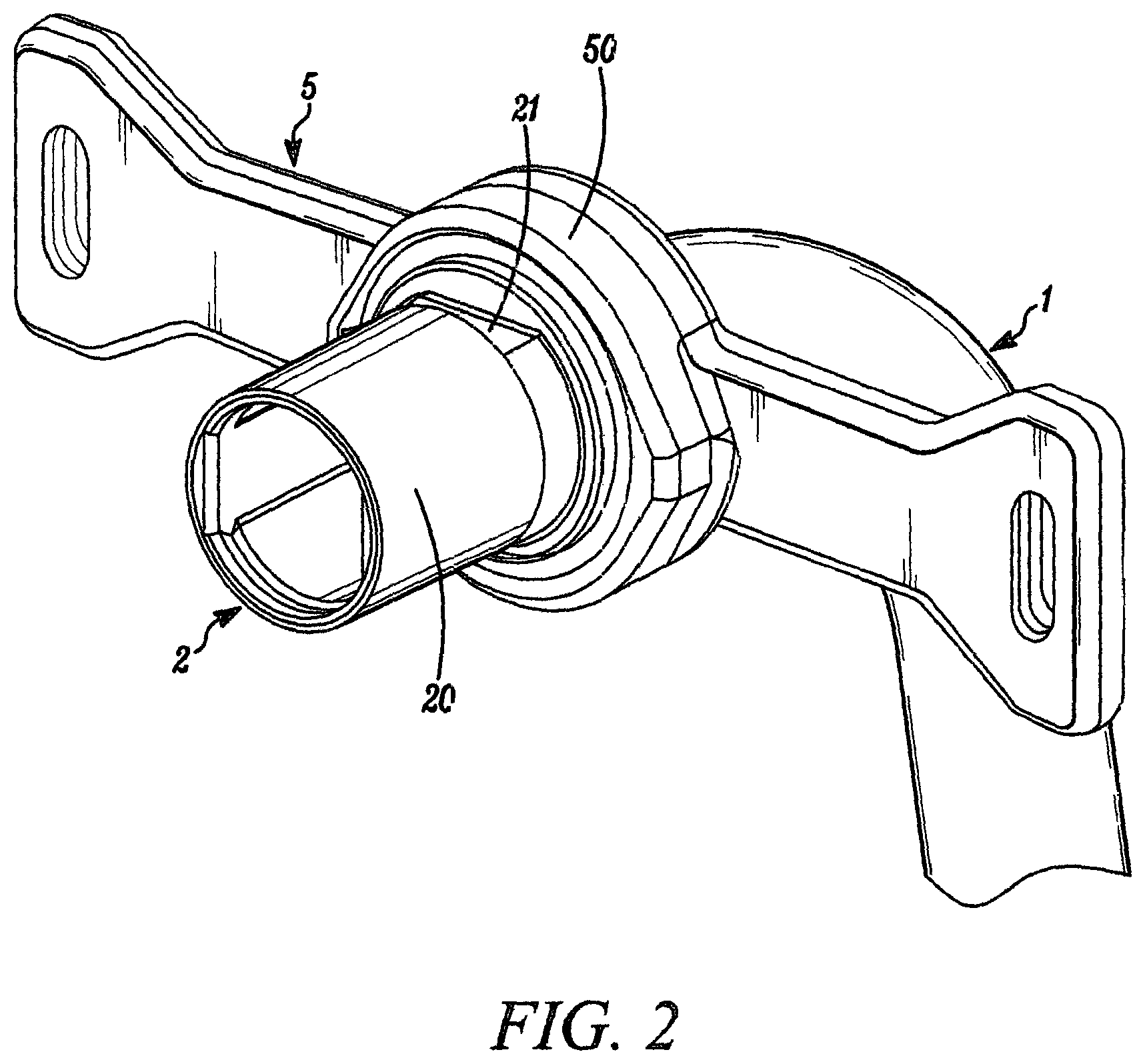 Patent US12611514 Figure 2 – Tracheostomy tubes and their manufacture