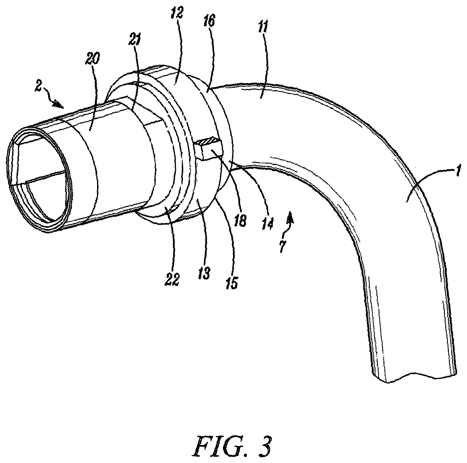 Patent US12611514 Figure 3 – Tracheostomy tubes and their manufacture