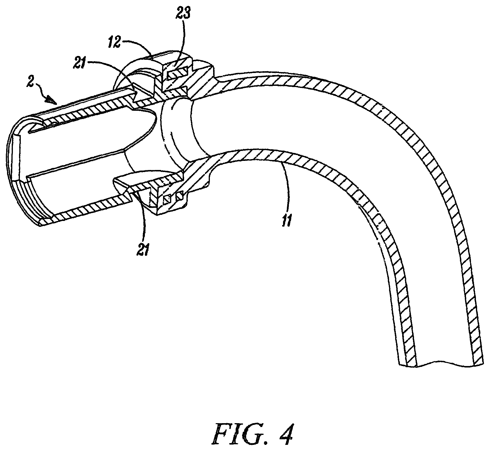 Patent US12611514 Figure 4 – Tracheostomy tubes and their manufacture