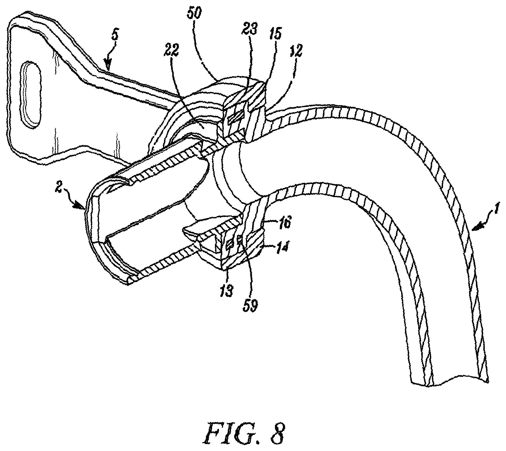 Patent US12611514 Figure 8 – Tracheostomy tubes and their manufacture