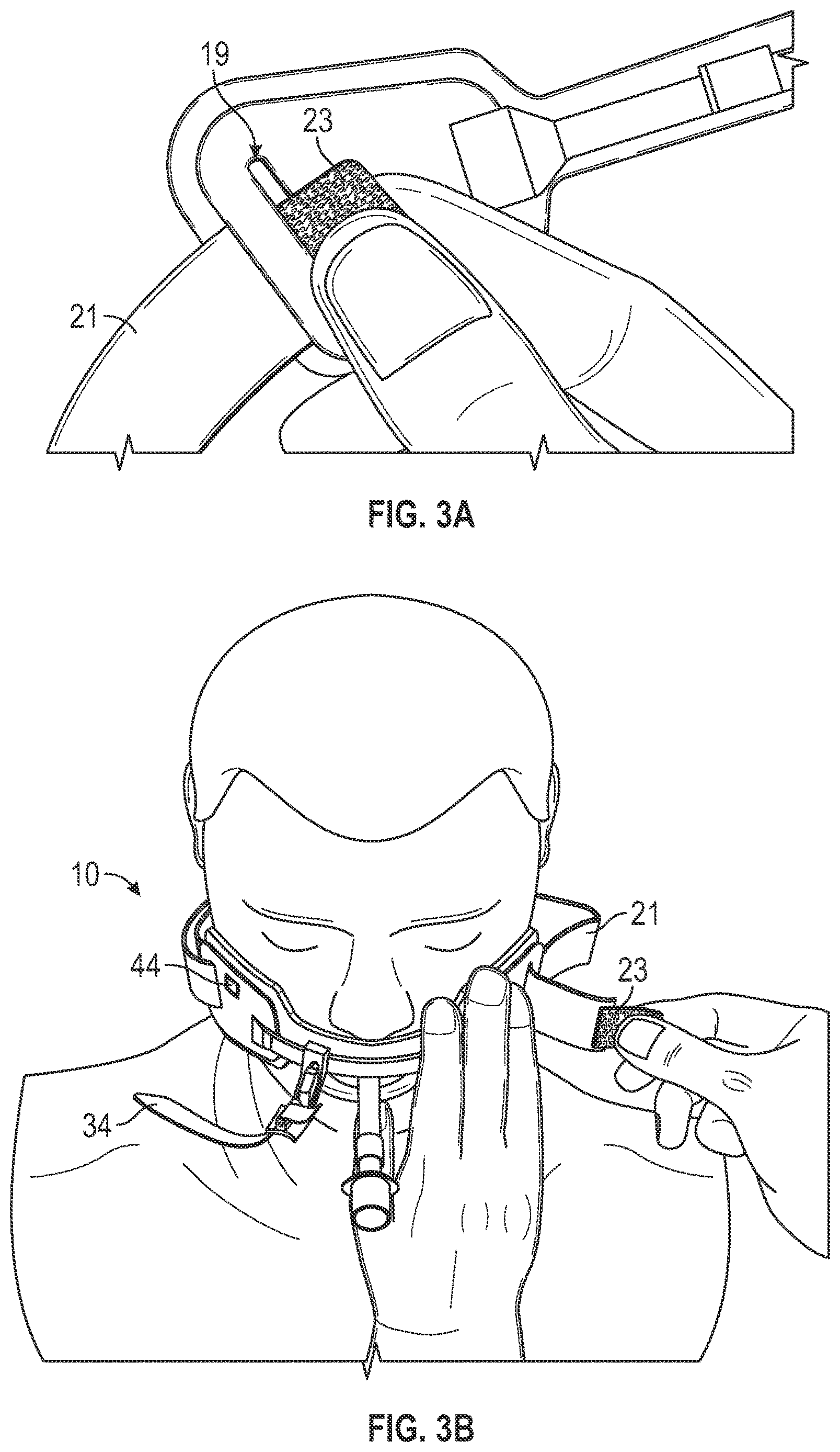 Patent US12611515 Figure 3 – Endotracheal tube holder