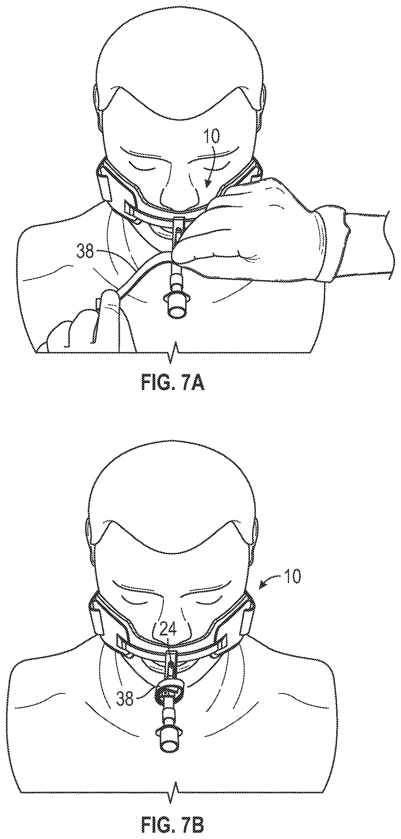 Patent US12611515 Figure 7 – Endotracheal tube holder