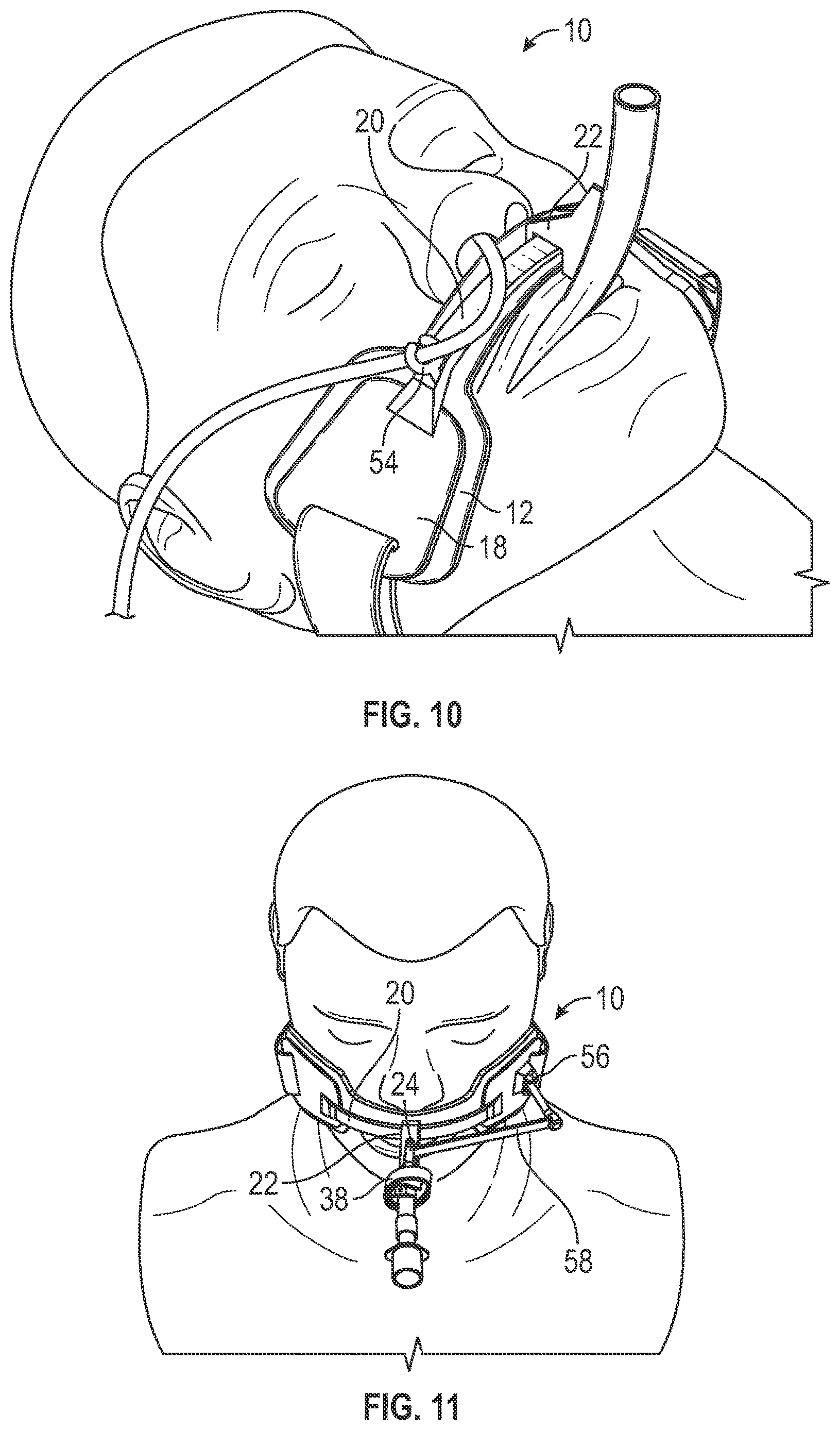 Patent US12611515 Figure 9 – Endotracheal tube holder