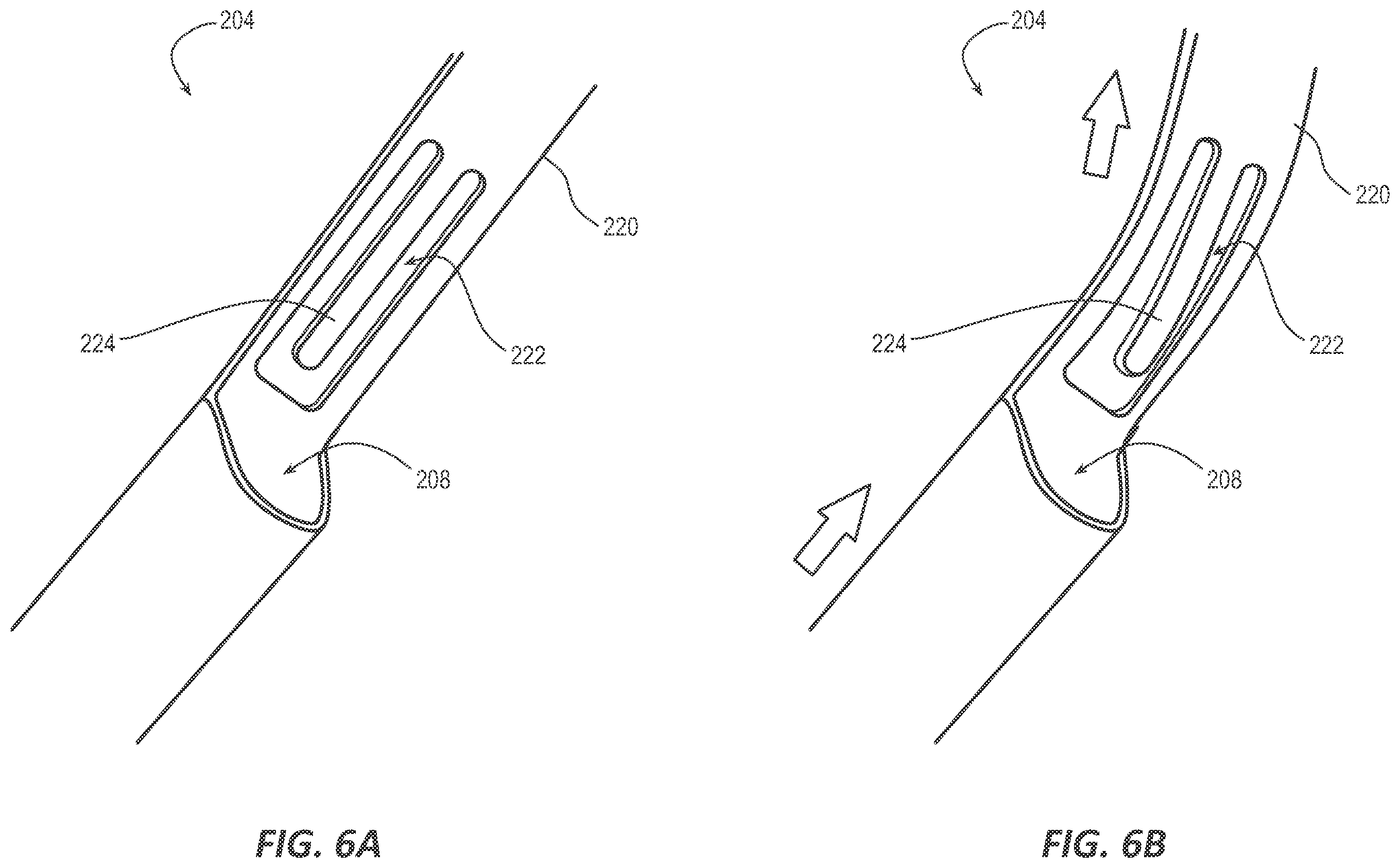 Patent US12611519 Figure 5 – Intermittent-catheter assembly and methods thereof