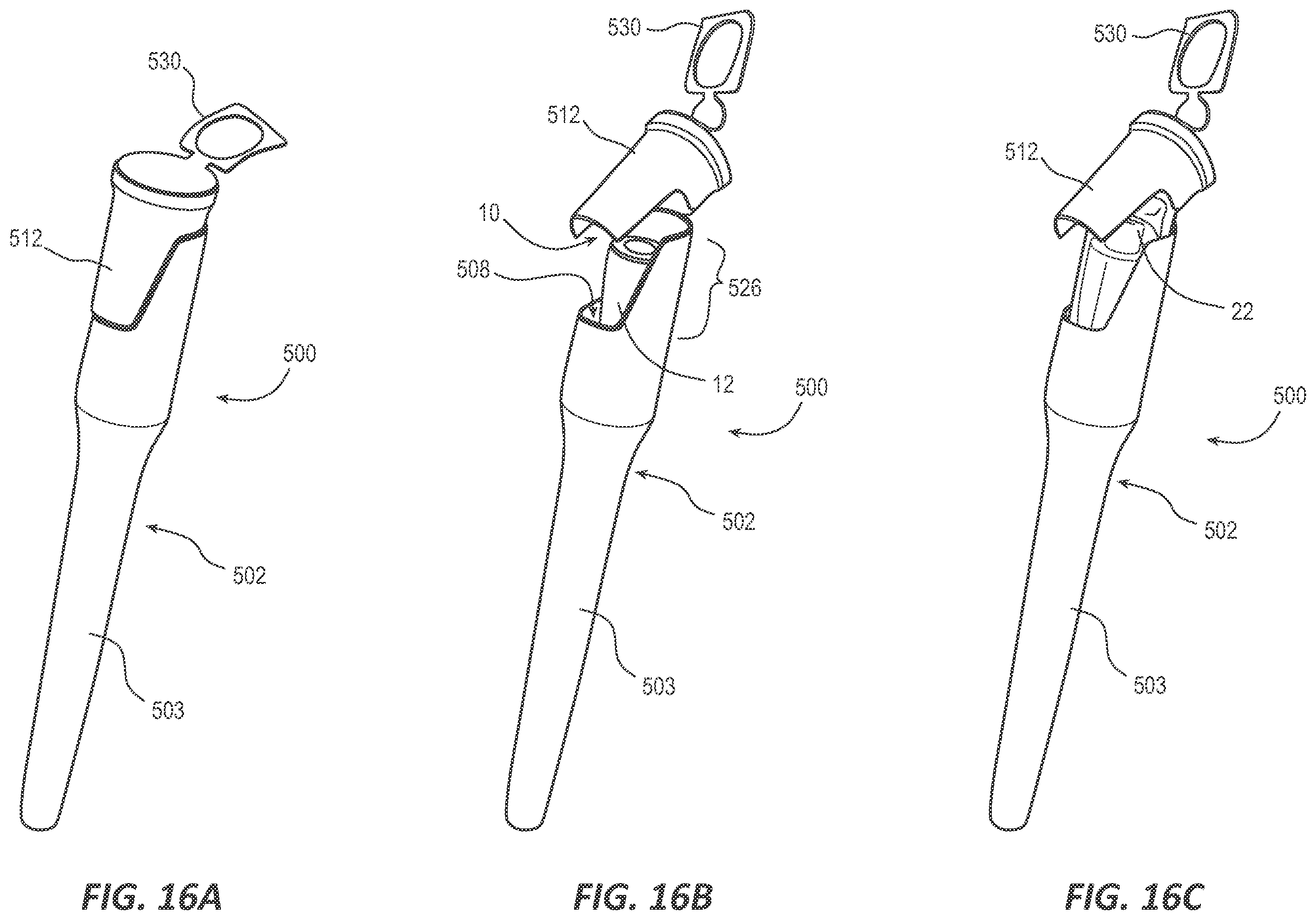 Patent US12611519 Figure 11 – Intermittent-catheter assembly and methods thereof