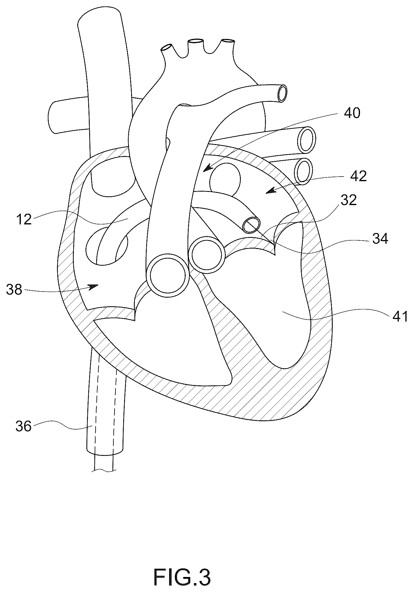 Patent US12611523 Figure 3 – Advanced 3-way steering