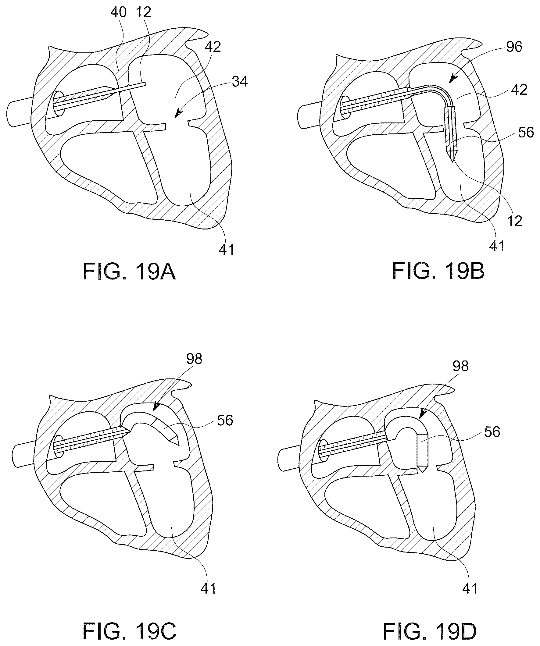 Patent US12611523 Figure 14 – Advanced 3-way steering