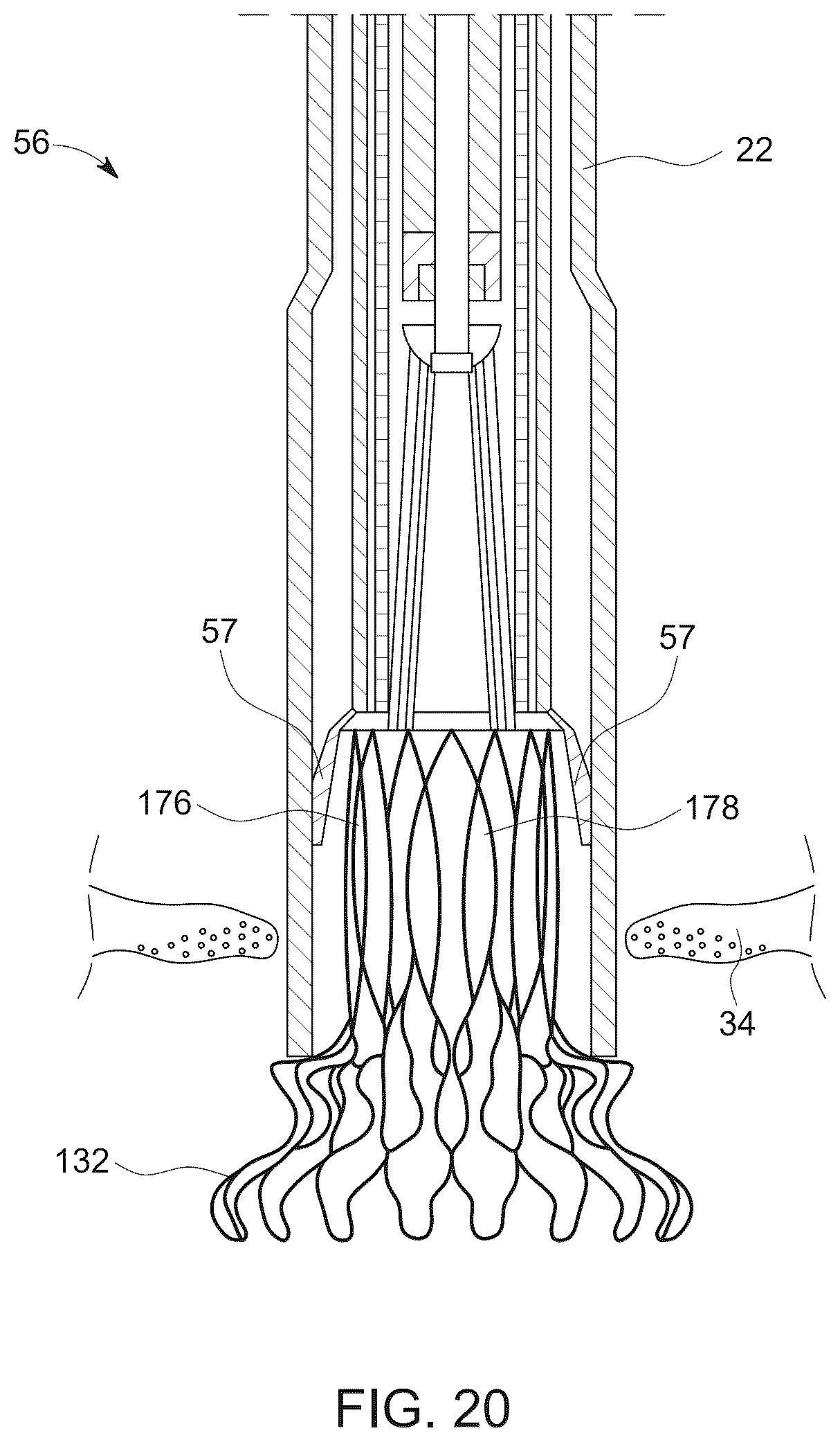 Patent US12611523 Figure 15 – Advanced 3-way steering