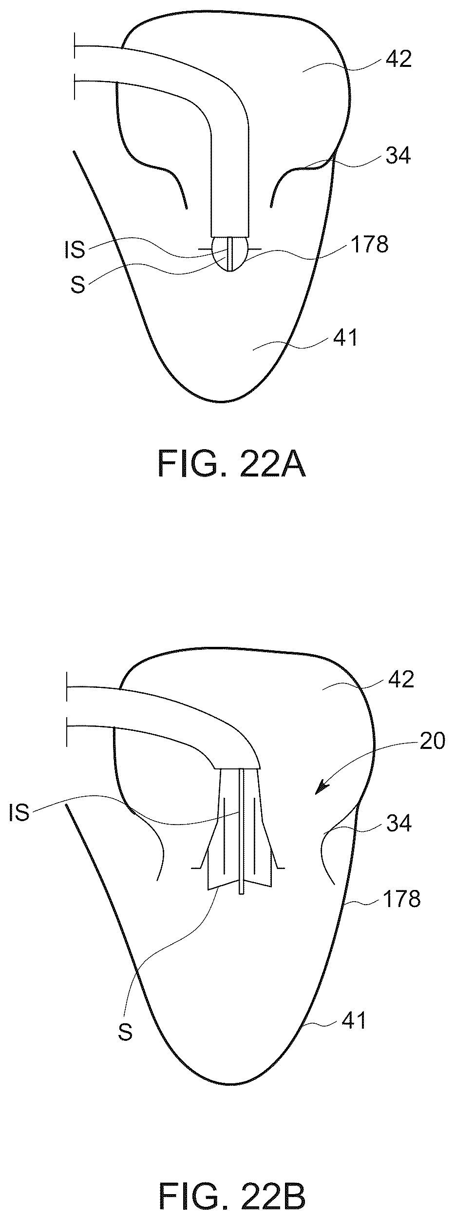 Patent US12611523 Figure 17 – Advanced 3-way steering
