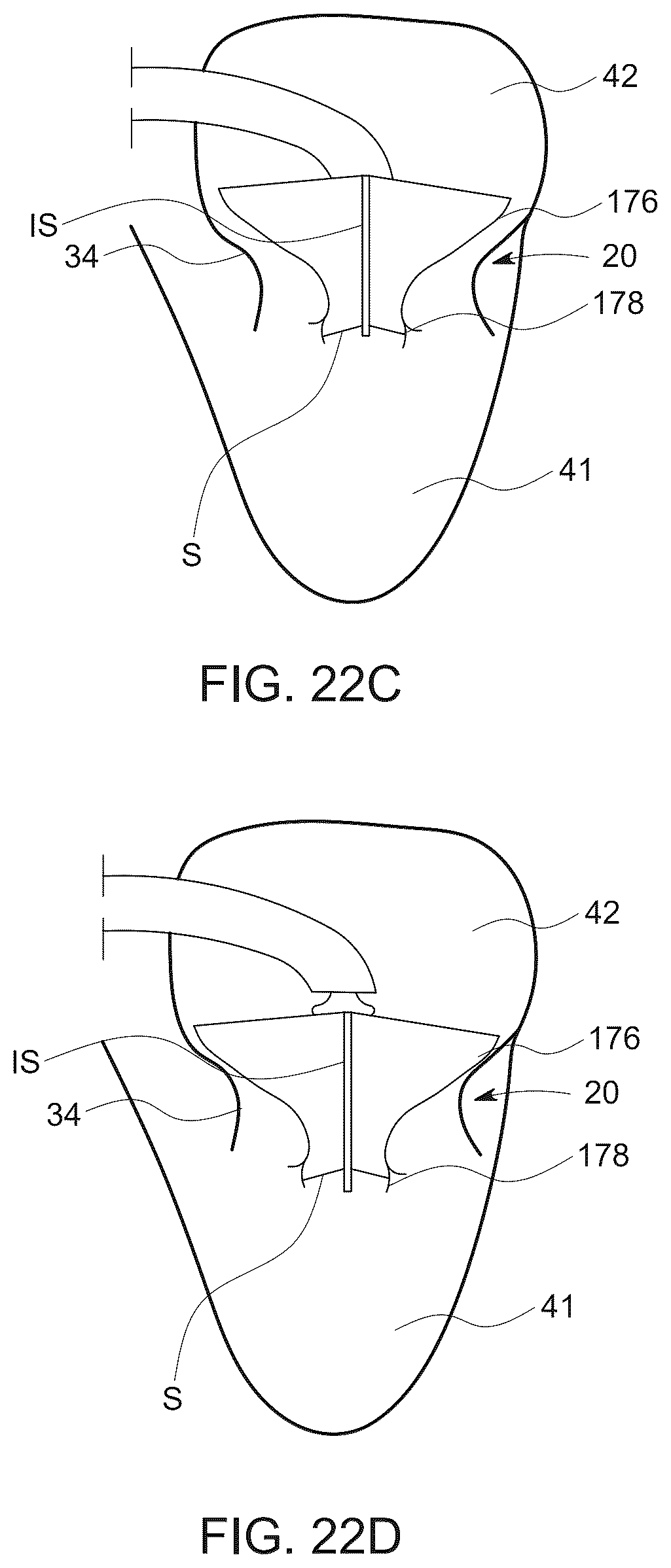 Patent US12611523 Figure 18 – Advanced 3-way steering