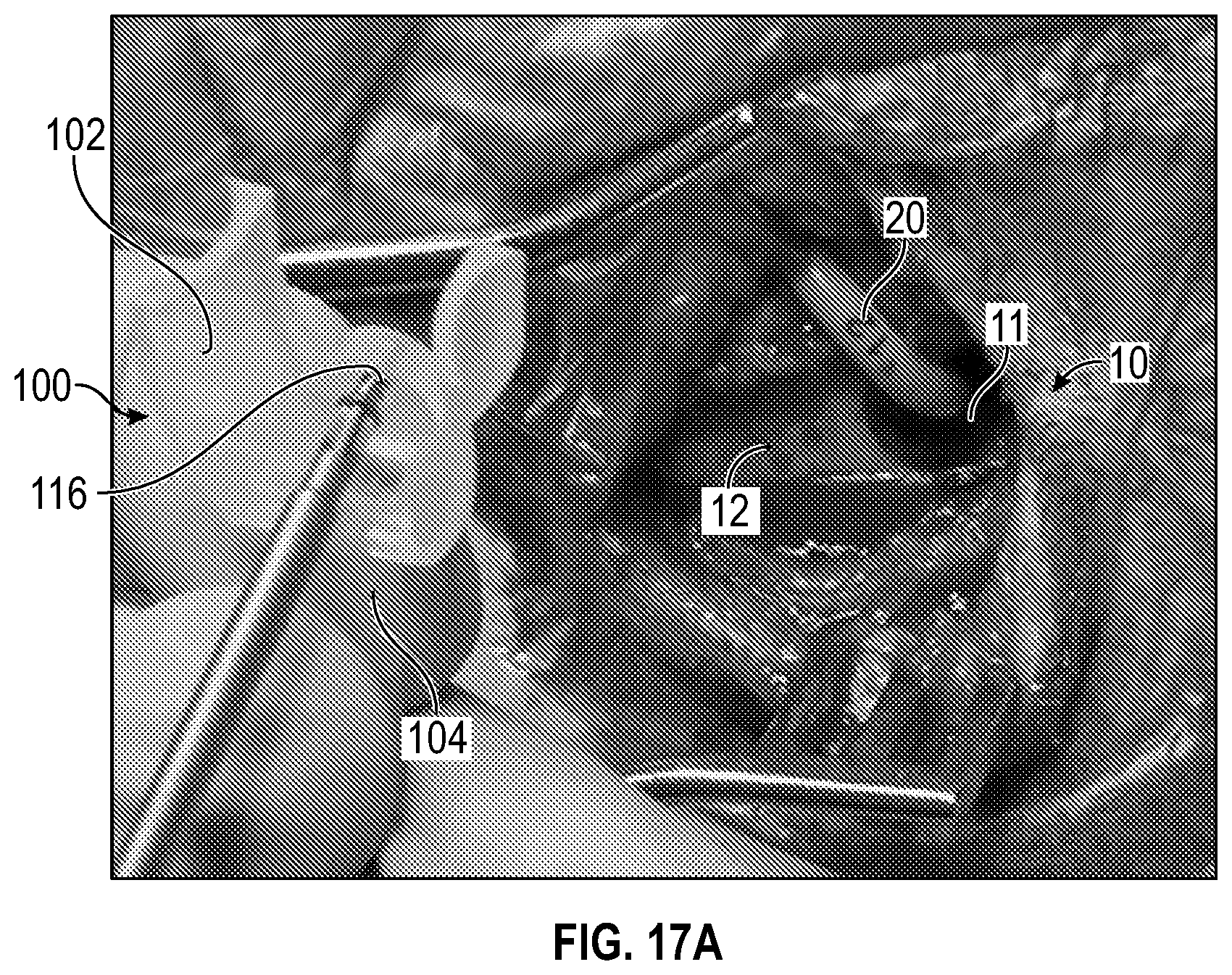 Patent US12611524 Figure 13 – Systems and methods for a catheter stabilization and occluder apparatus
