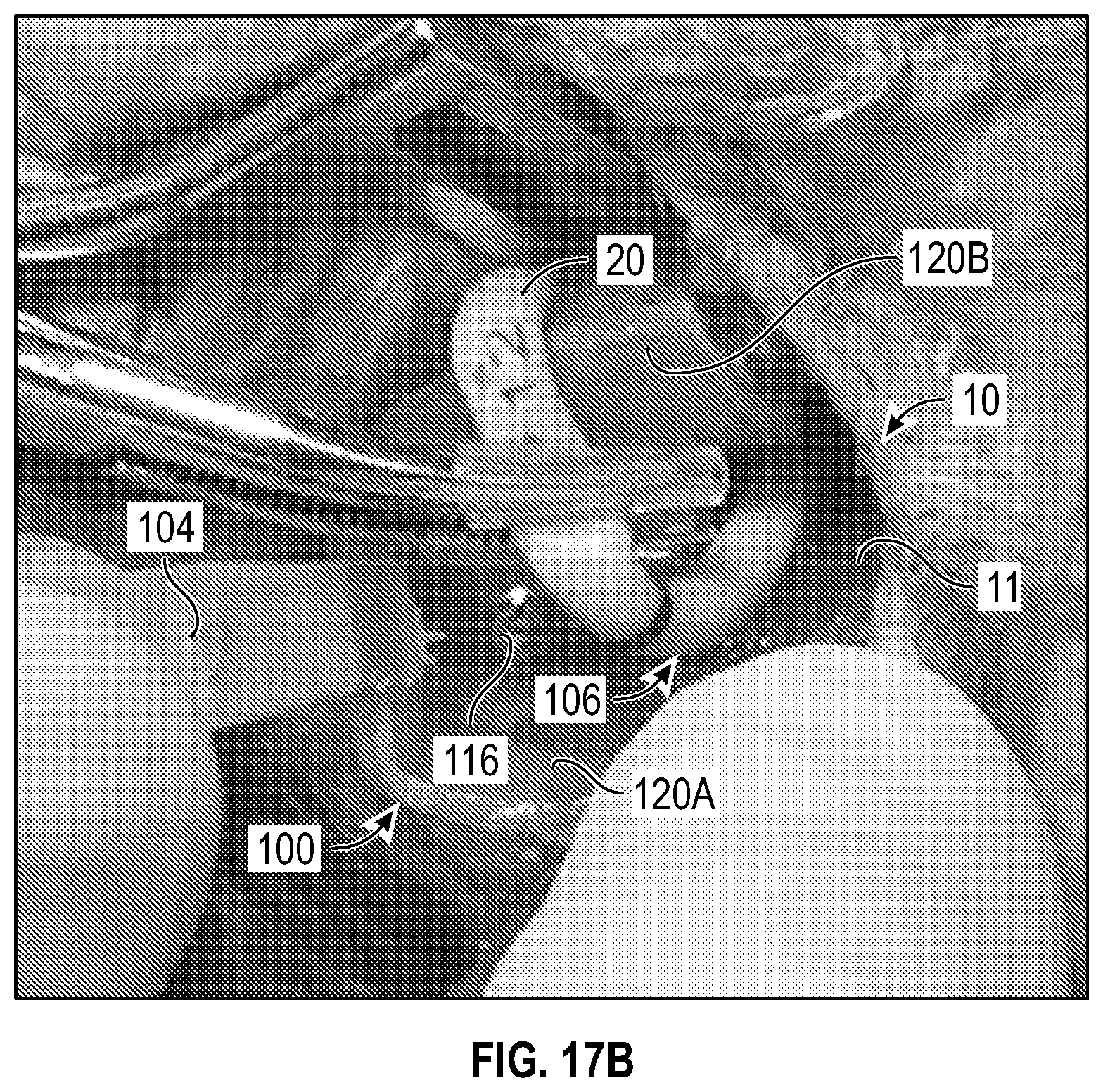 Patent US12611524 Figure 14 – Systems and methods for a catheter stabilization and occluder apparatus