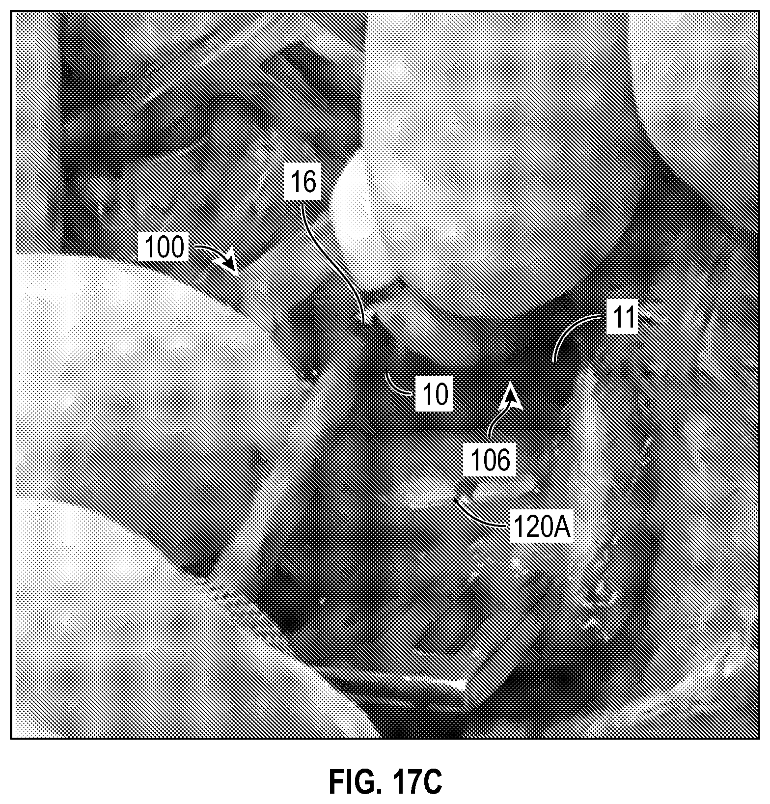 Patent US12611524 Figure 15 – Systems and methods for a catheter stabilization and occluder apparatus