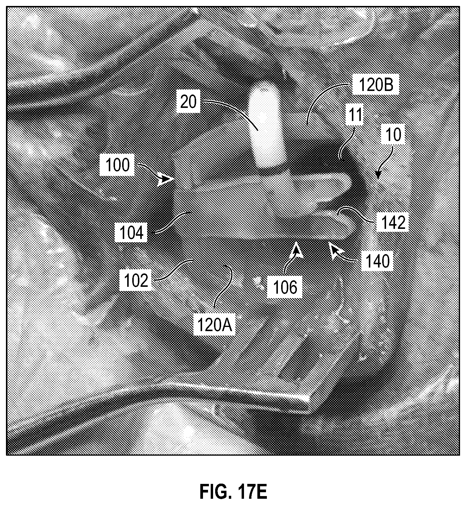Patent US12611524 Figure 17 – Systems and methods for a catheter stabilization and occluder apparatus