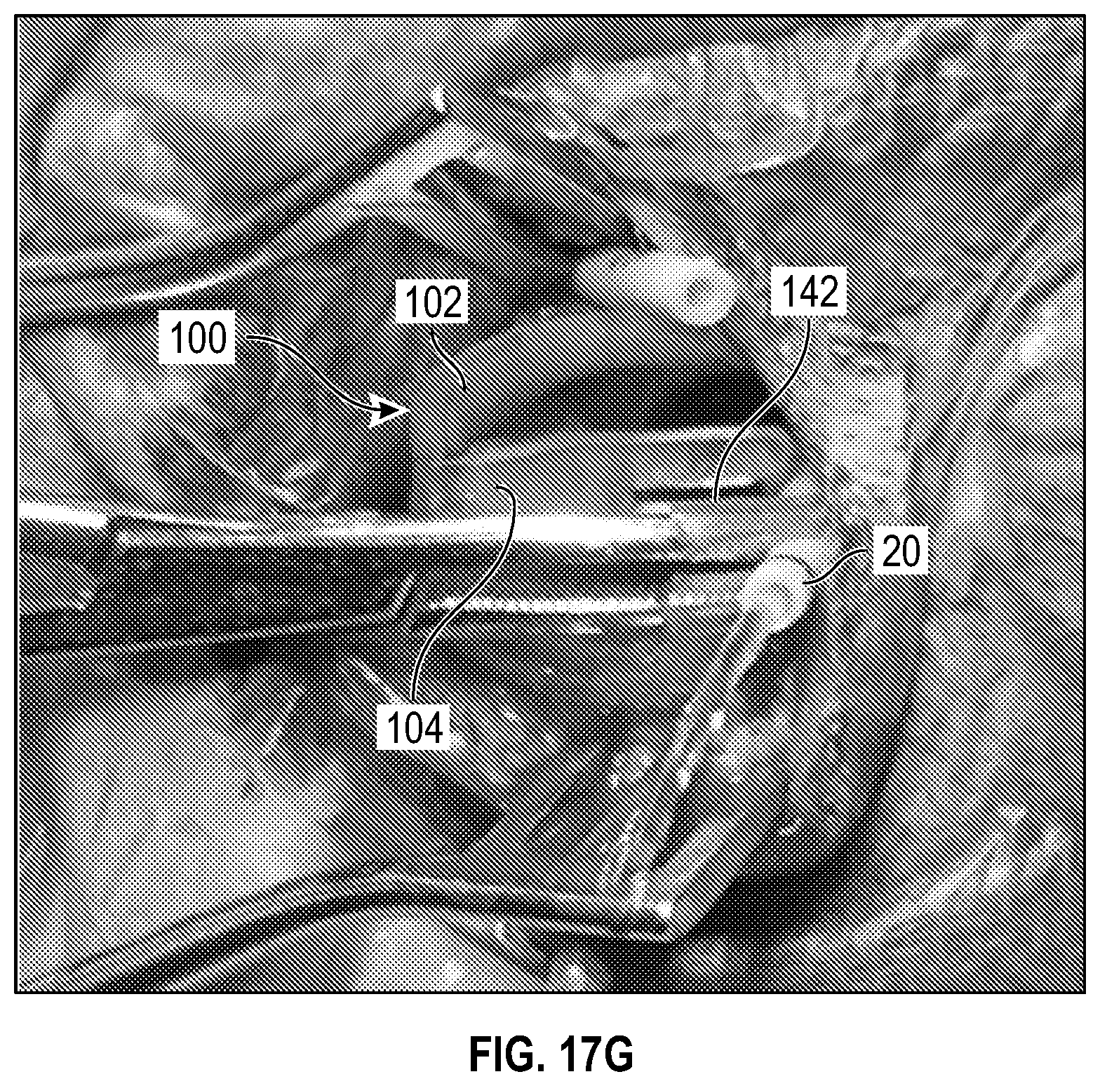 Patent US12611524 Figure 19 – Systems and methods for a catheter stabilization and occluder apparatus