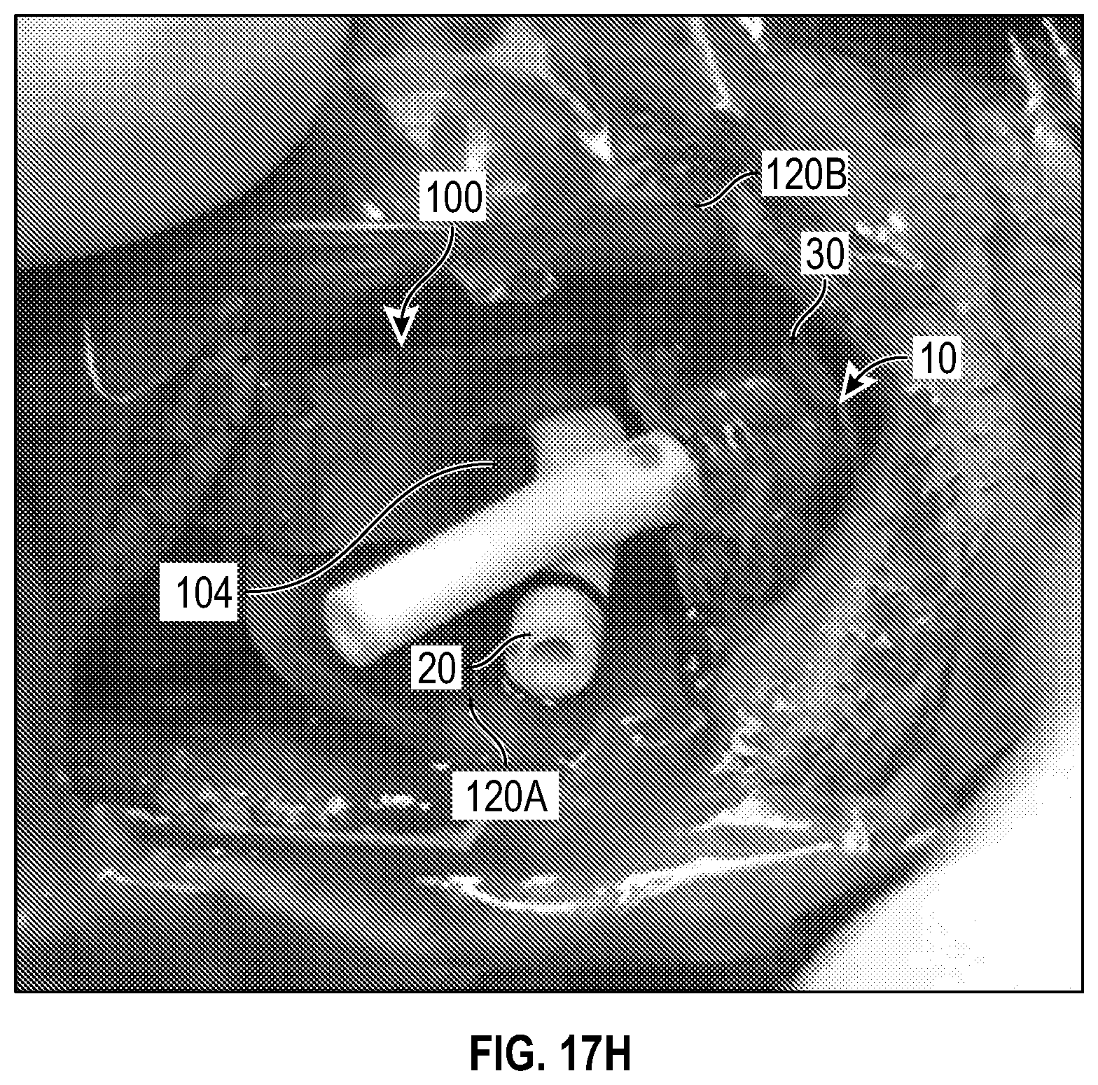 Patent US12611524 Figure 20 – Systems and methods for a catheter stabilization and occluder apparatus