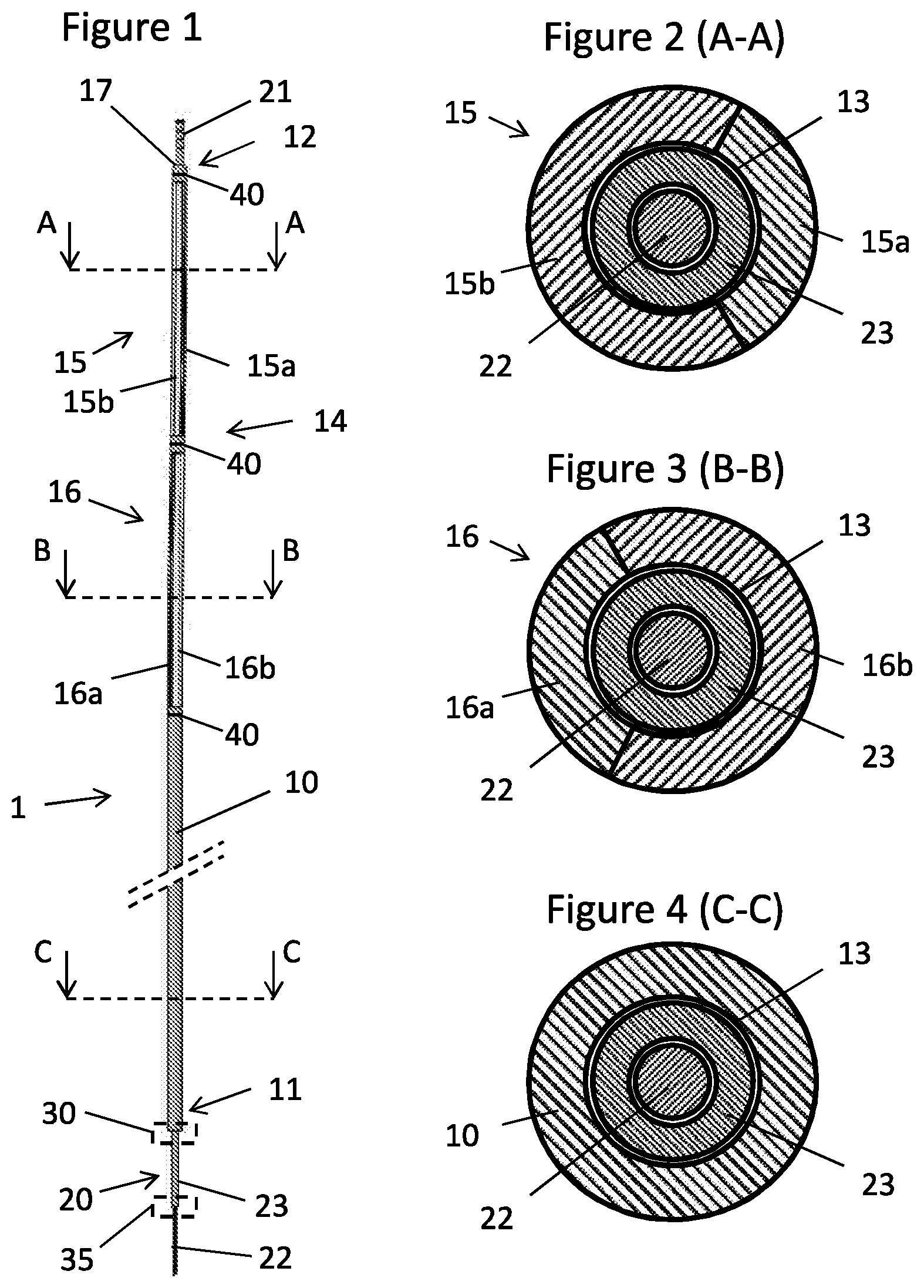 Patent US12611525 Figure 1 – Guide wire-catheter assembly