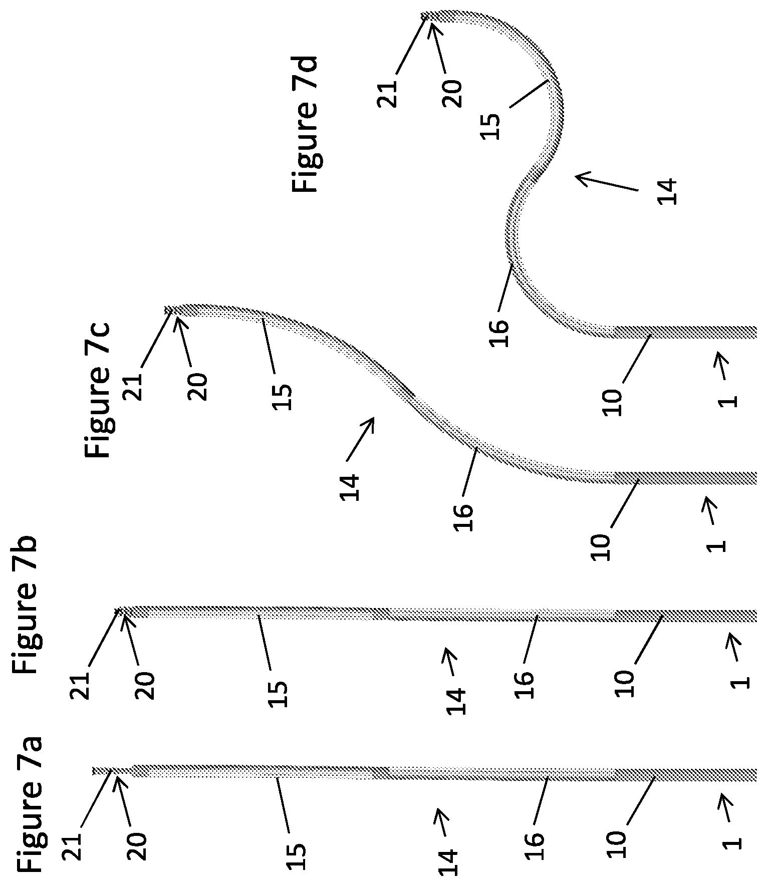 Patent US12611525 Figure 3 – Guide wire-catheter assembly