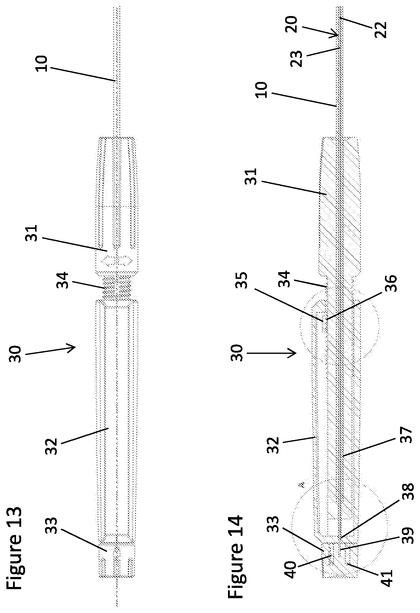 Patent US12611525 Figure 6 – Guide wire-catheter assembly