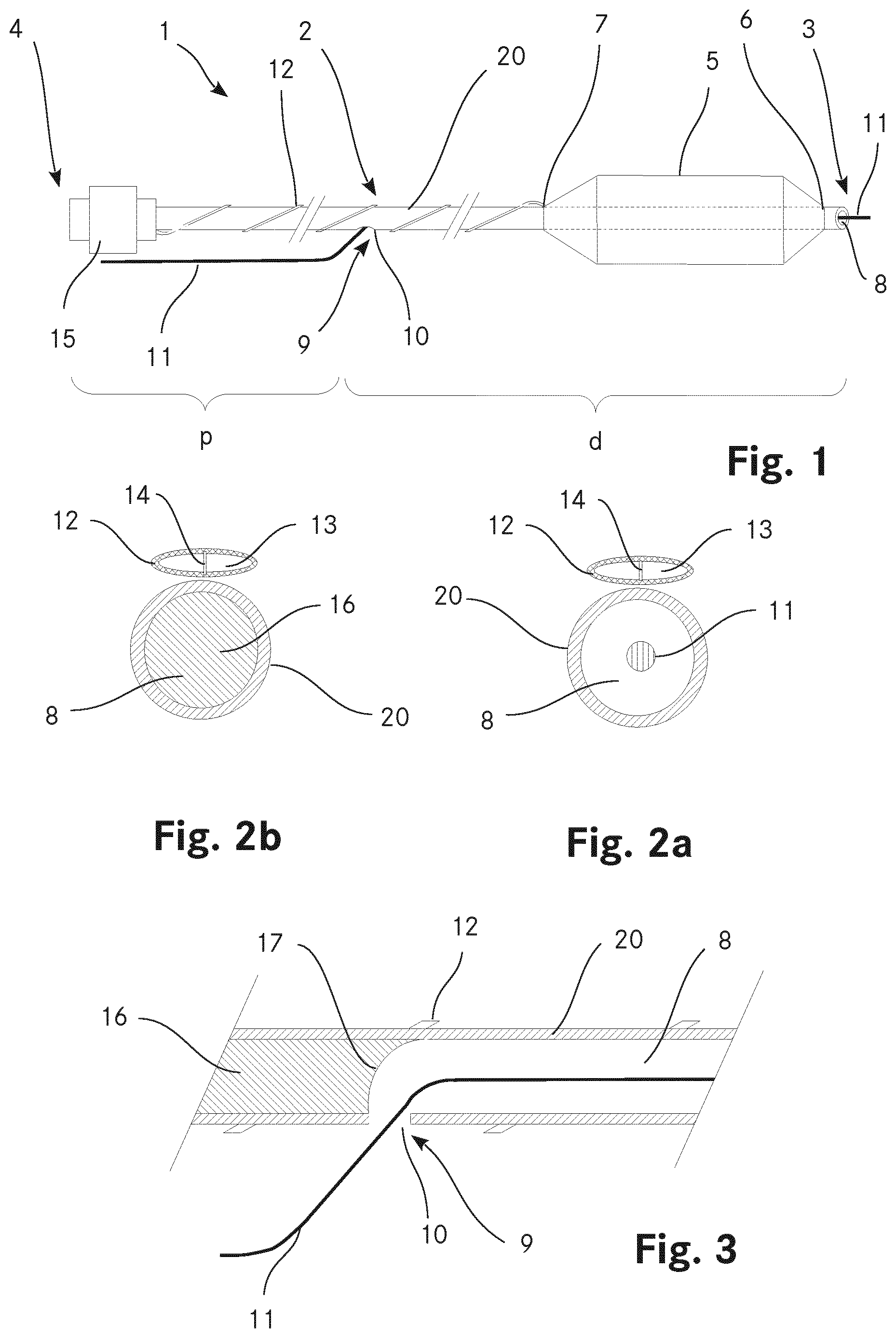 Patent US12611527 — Catheter with a balloon and a separate inflation lumen — Figure 1