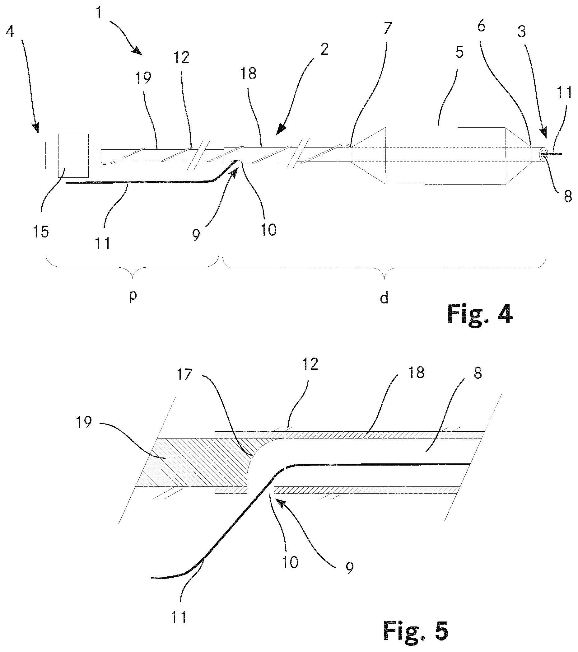Patent US12611527 Figure 2 – Catheter with a balloon and a separate inflation lumen
