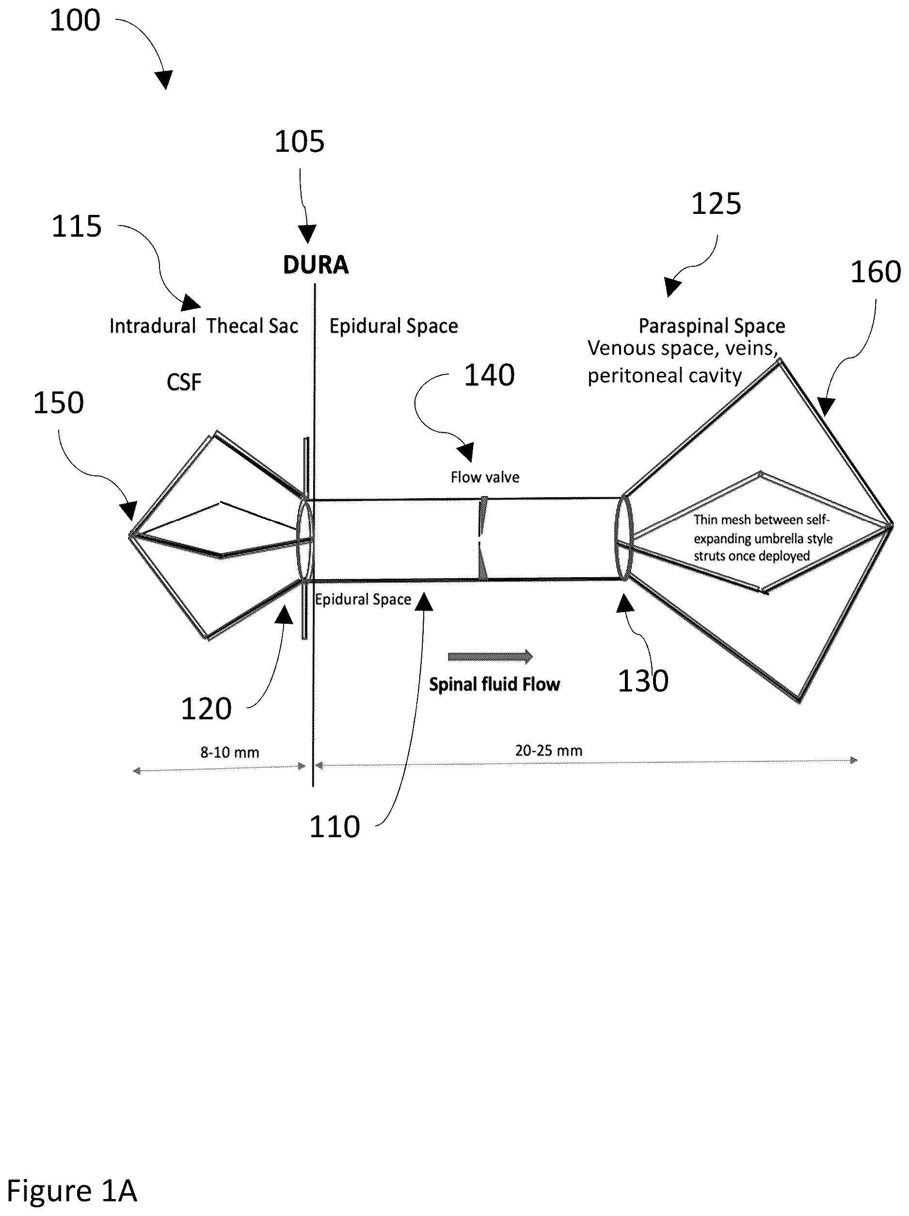 Patent US12611528 Figure 1 – Systems and methods for draining cerebrospinal fluid