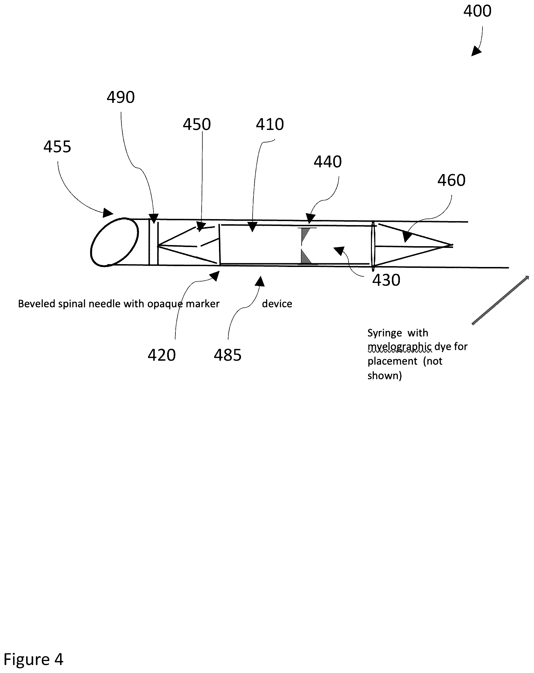 Patent US12611528 Figure 5 – Systems and methods for draining cerebrospinal fluid