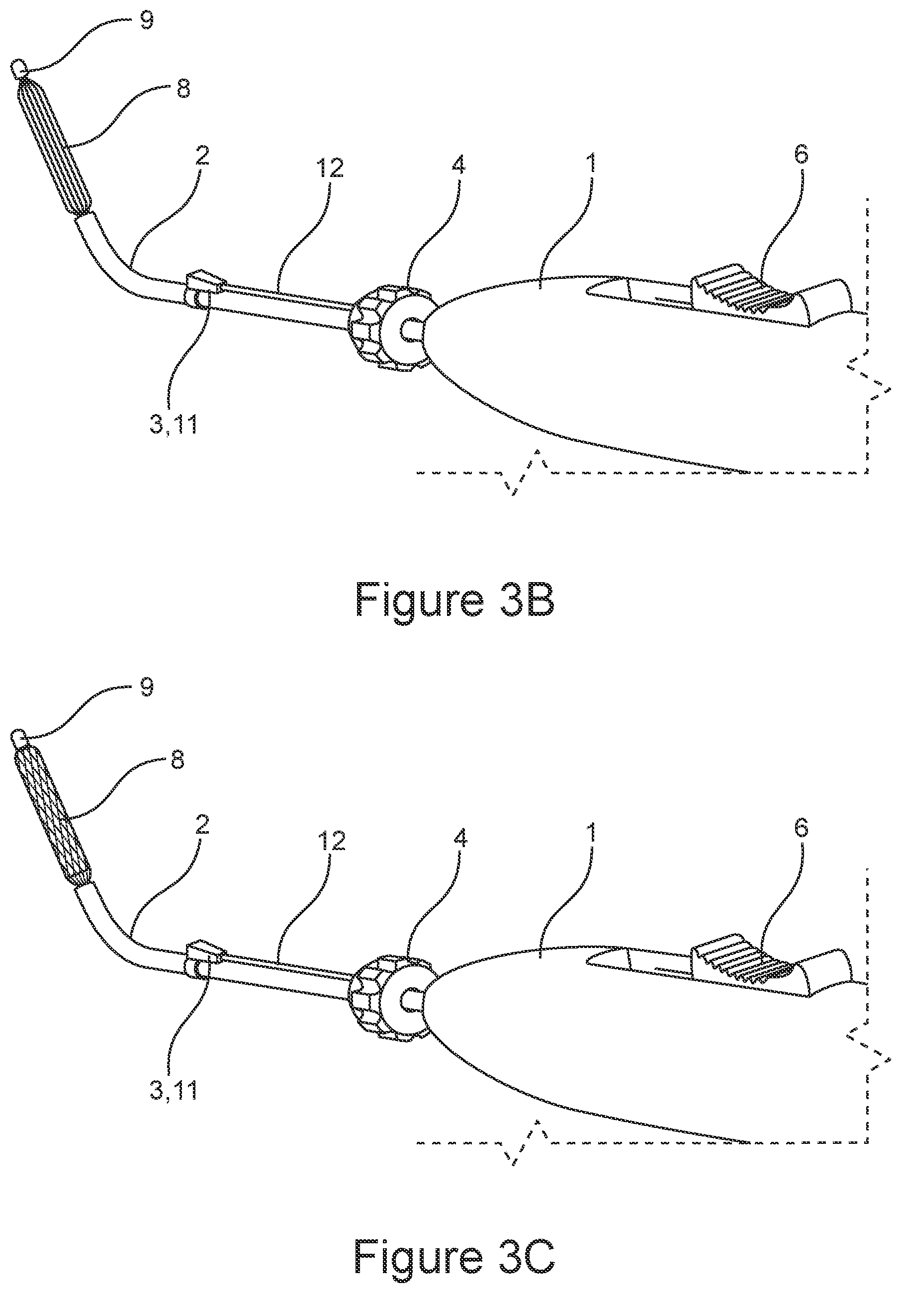 Patent US12611529 Figure 3 – Delivery device for eustachian tube procedures