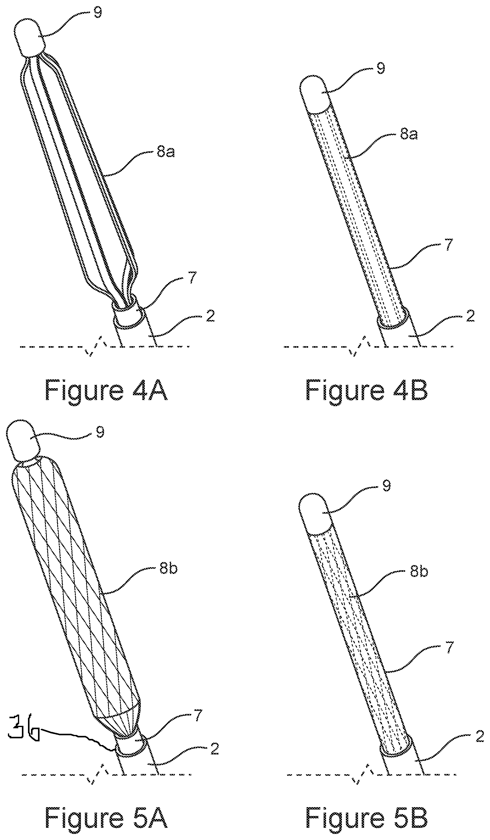Patent US12611529 Figure 4 – Delivery device for eustachian tube procedures