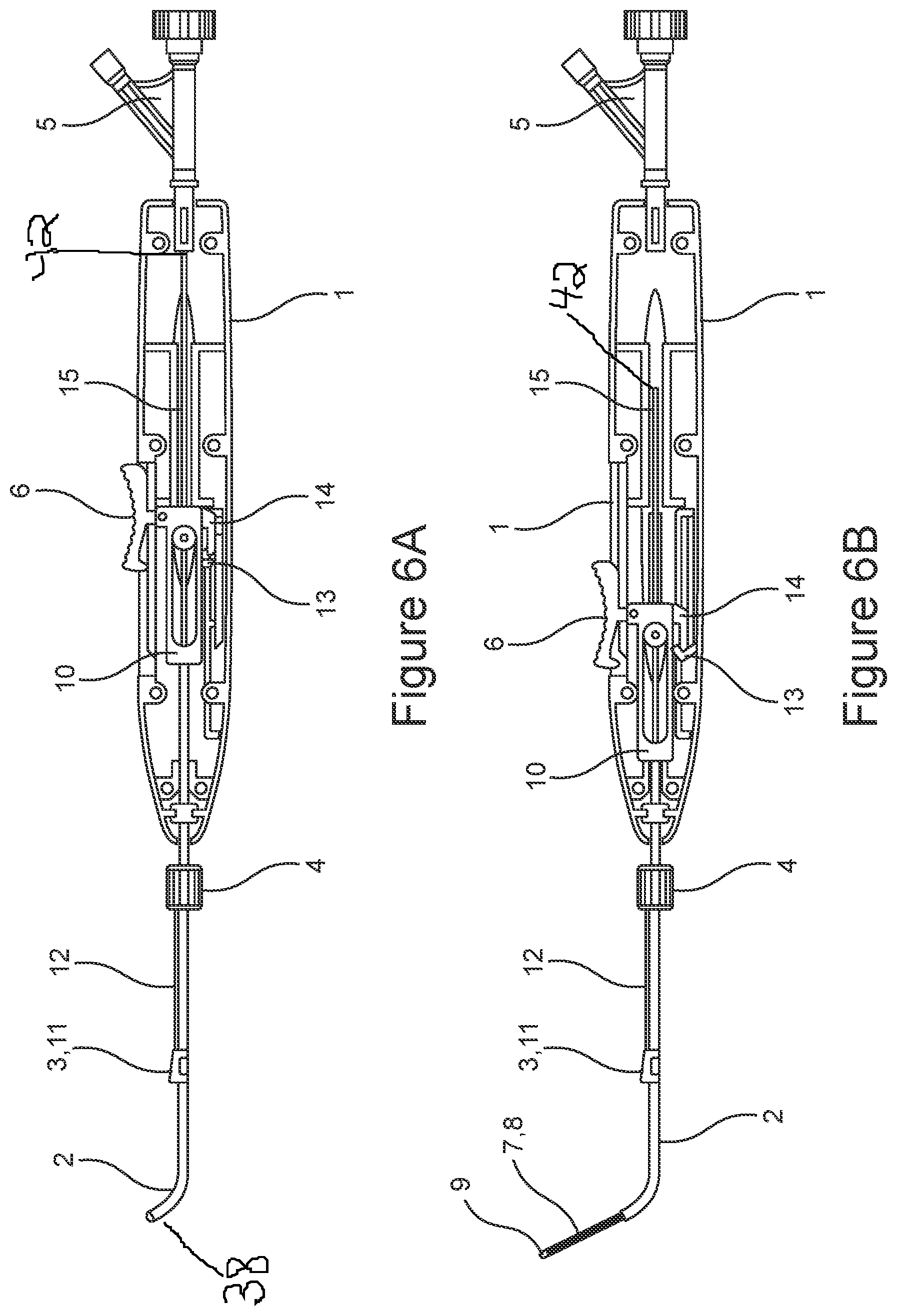 Patent US12611529 Figure 5 – Delivery device for eustachian tube procedures