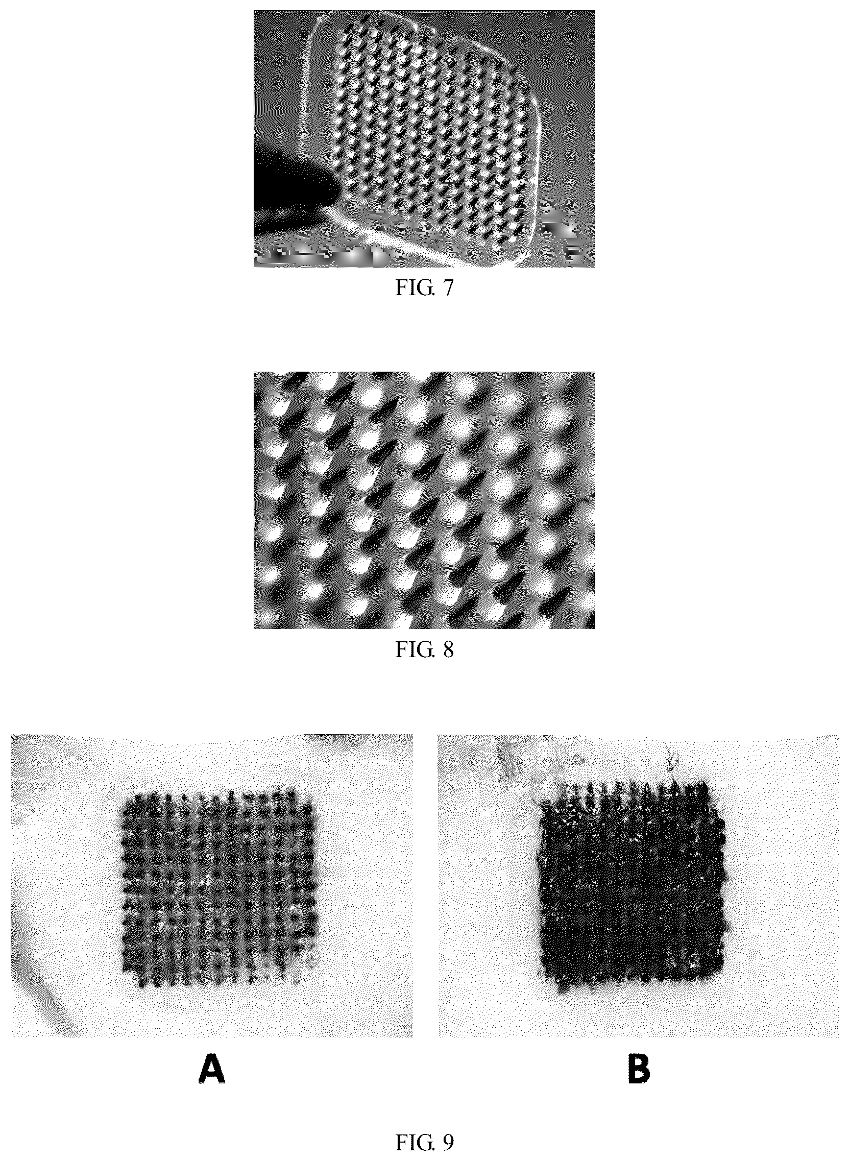 Patent US12611531 Figure 3 – Coated microneedle with multilayer structure, method for preparing the same and microneedle patch comprising coated microneedle