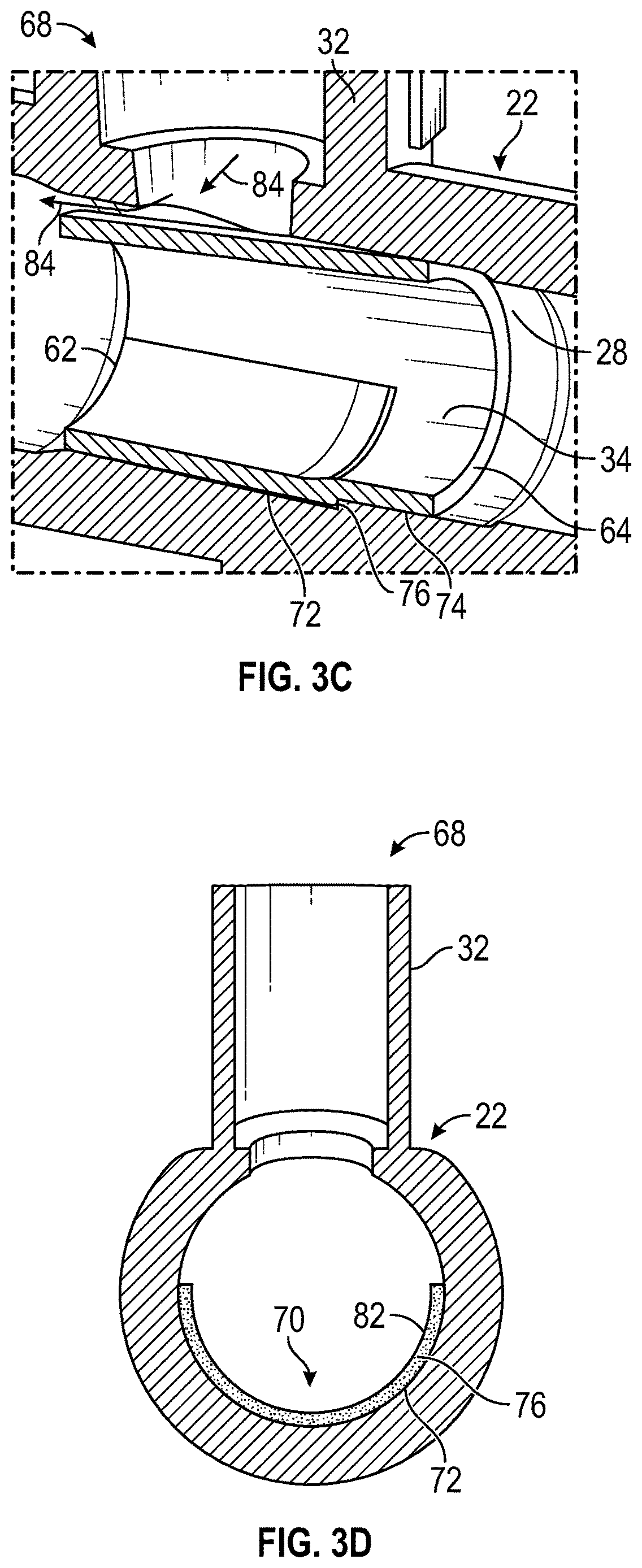 Patent US12611533 Figure 5 – Annular valve securement within a catheter assembly