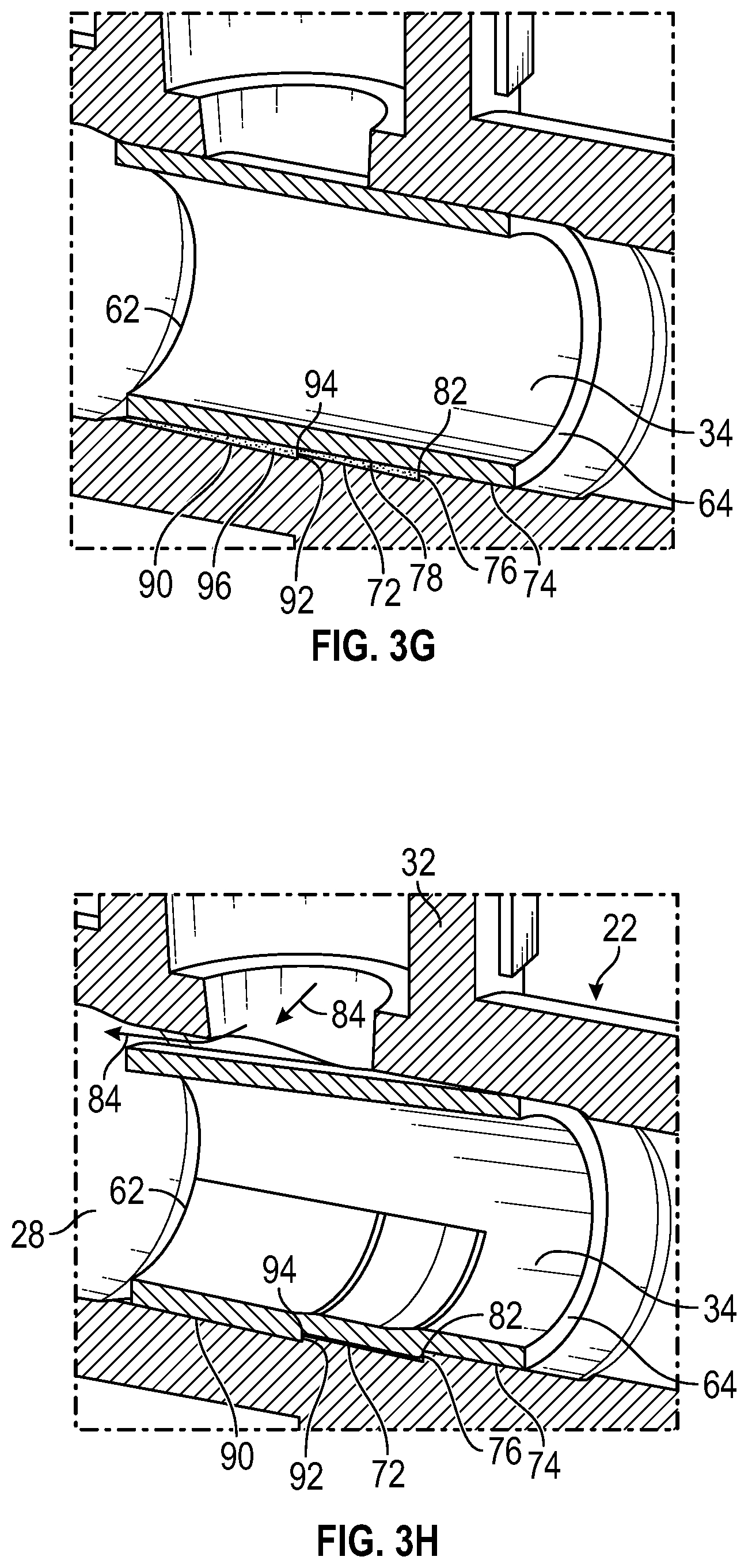Patent US12611533 Figure 7 – Annular valve securement within a catheter assembly